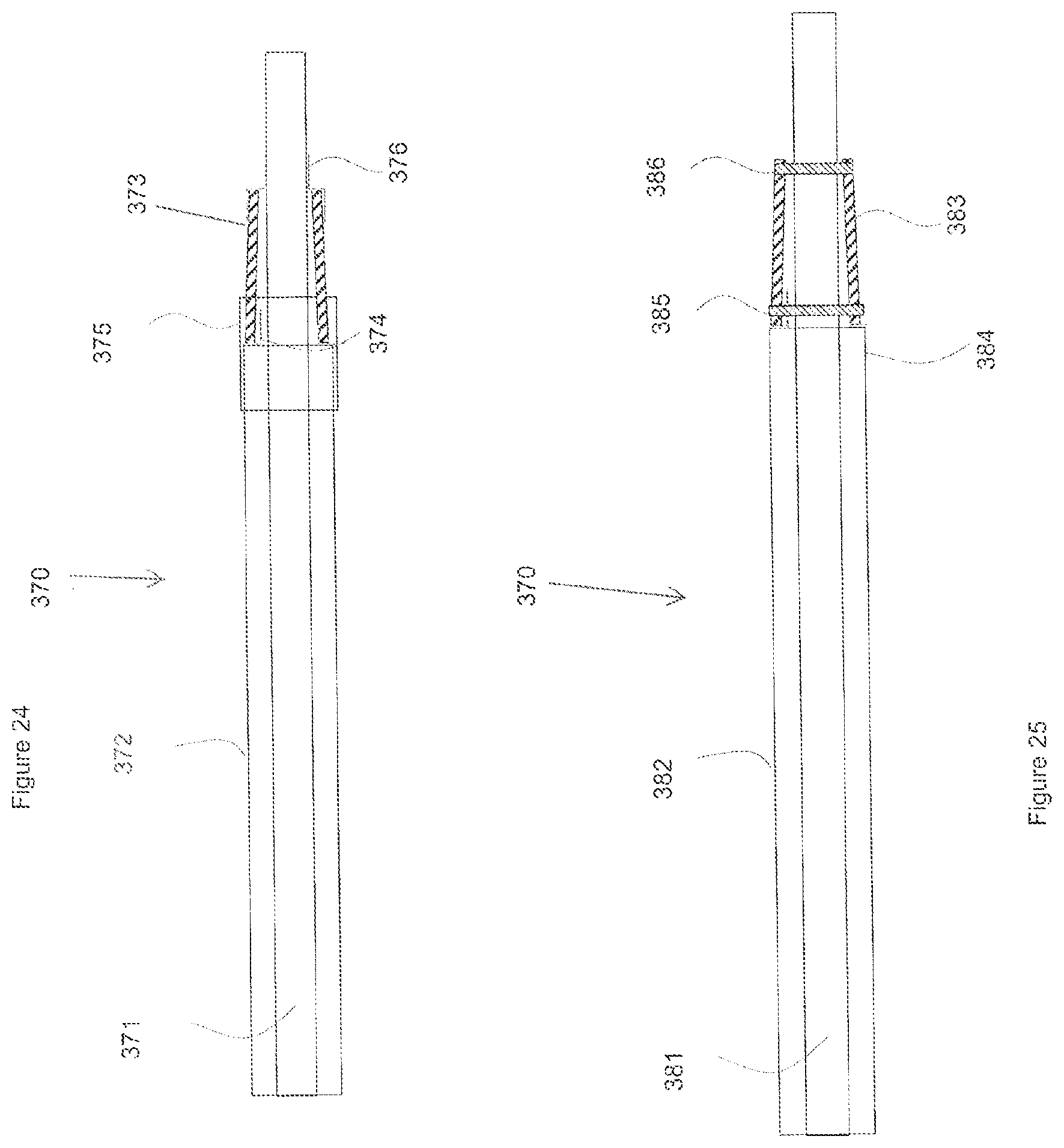 Patent US12569653 Figure 18 – Balloon catheters and methods of manufacture and use