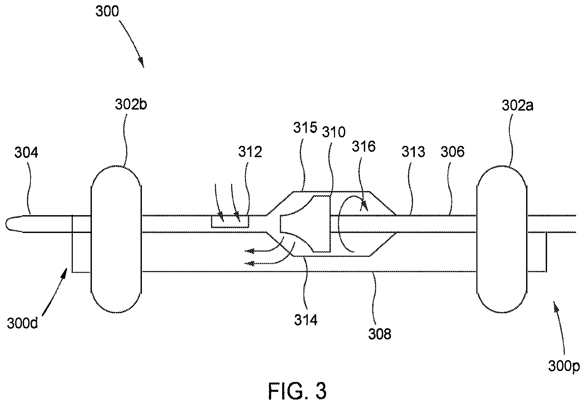 Patent US12569654 Figure 3 – Systems and methods for treatment of fluid overload