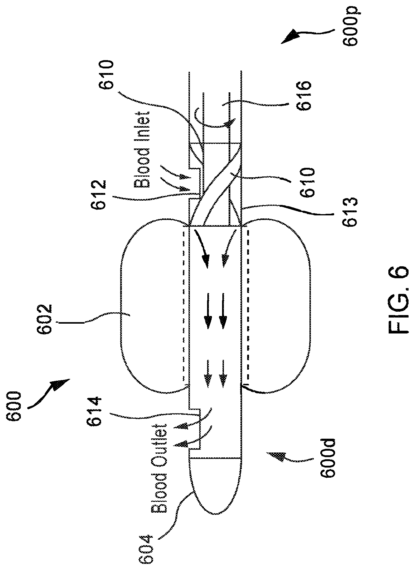 Patent US12569654 Figure 6 – Systems and methods for treatment of fluid overload