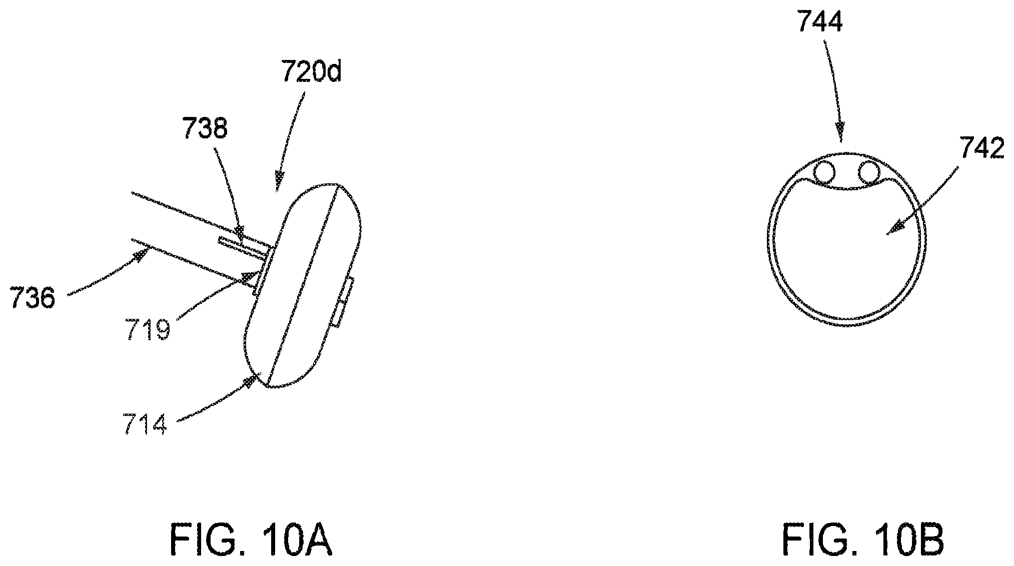 Patent US12569654 Figure 10 – Systems and methods for treatment of fluid overload