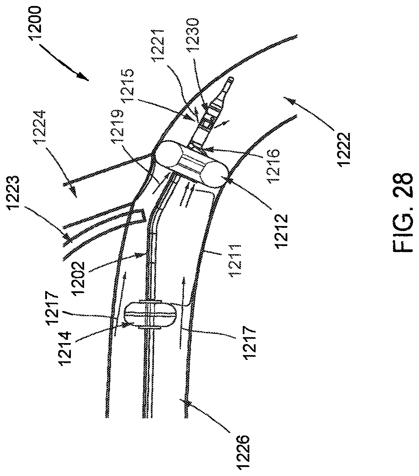 Patent US12569654 Figure 19 – Systems and methods for treatment of fluid overload