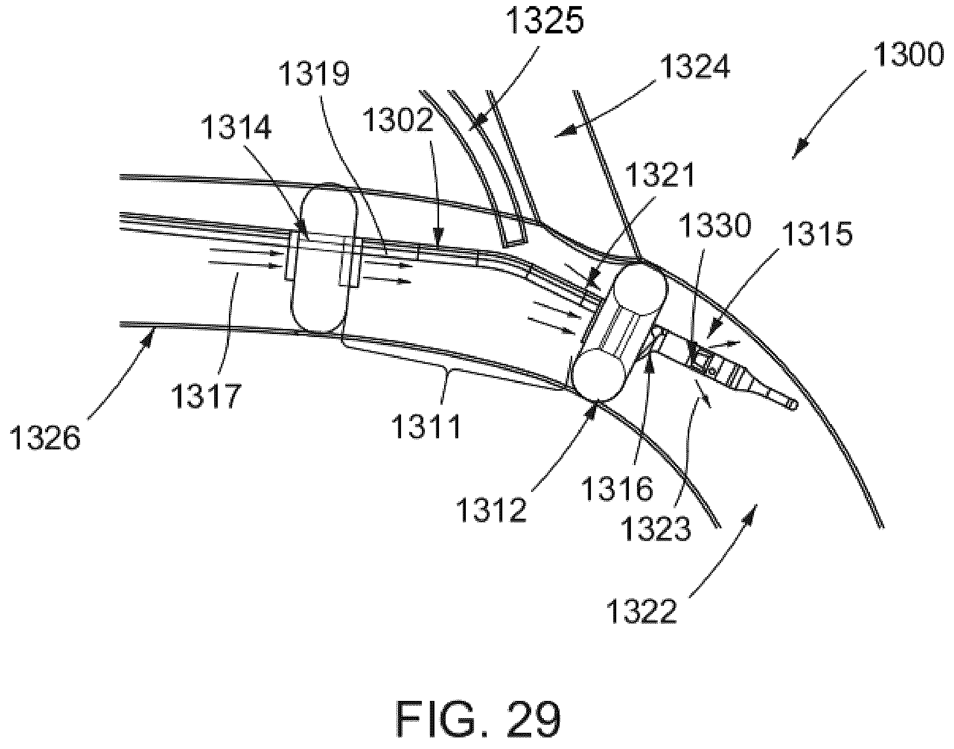 Patent US12569654 Figure 20 – Systems and methods for treatment of fluid overload
