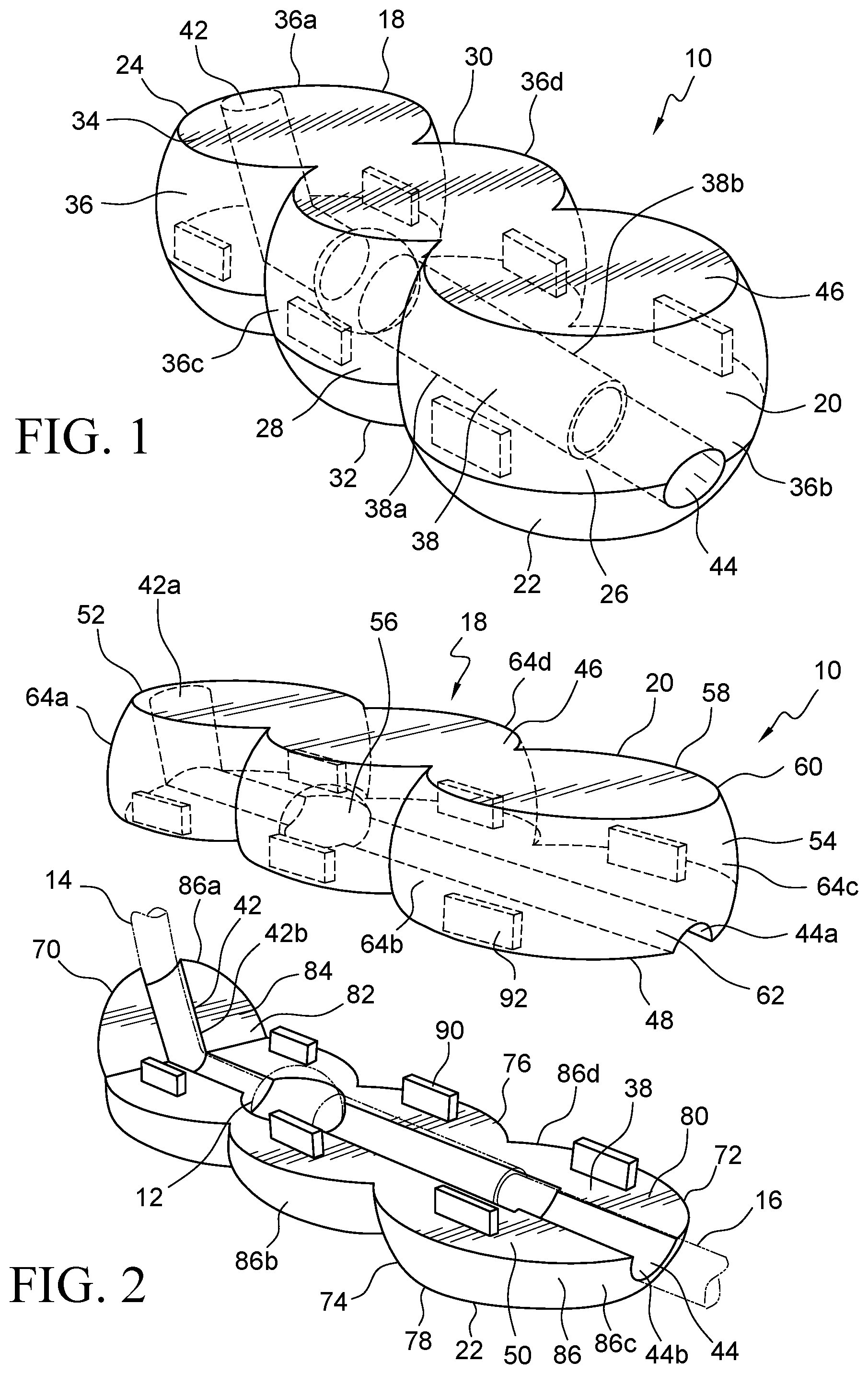 Patent US12569655 Figure 1 – Cerebral spinal fluid shunt plug