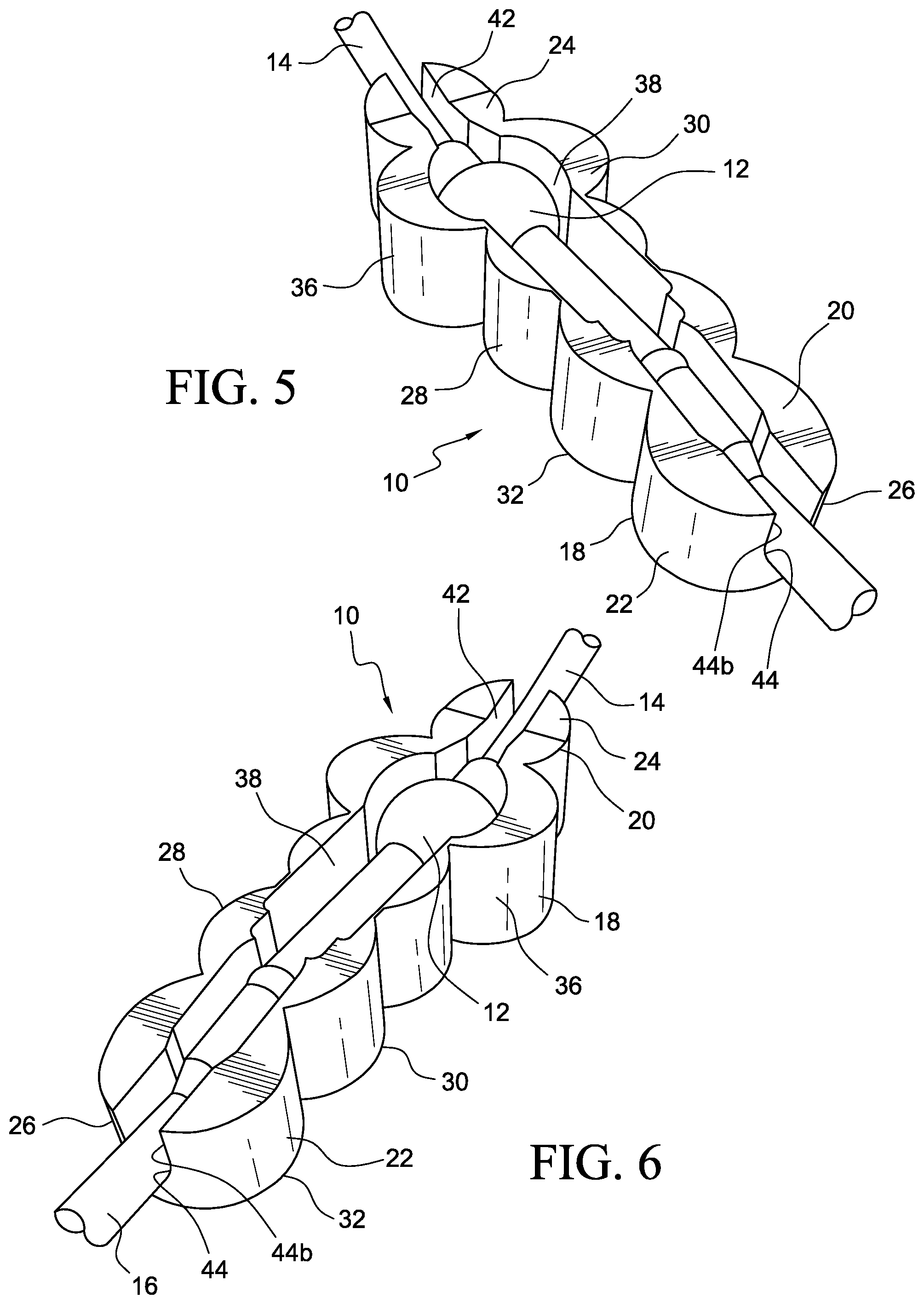 Patent US12569655 Figure 3 – Cerebral spinal fluid shunt plug