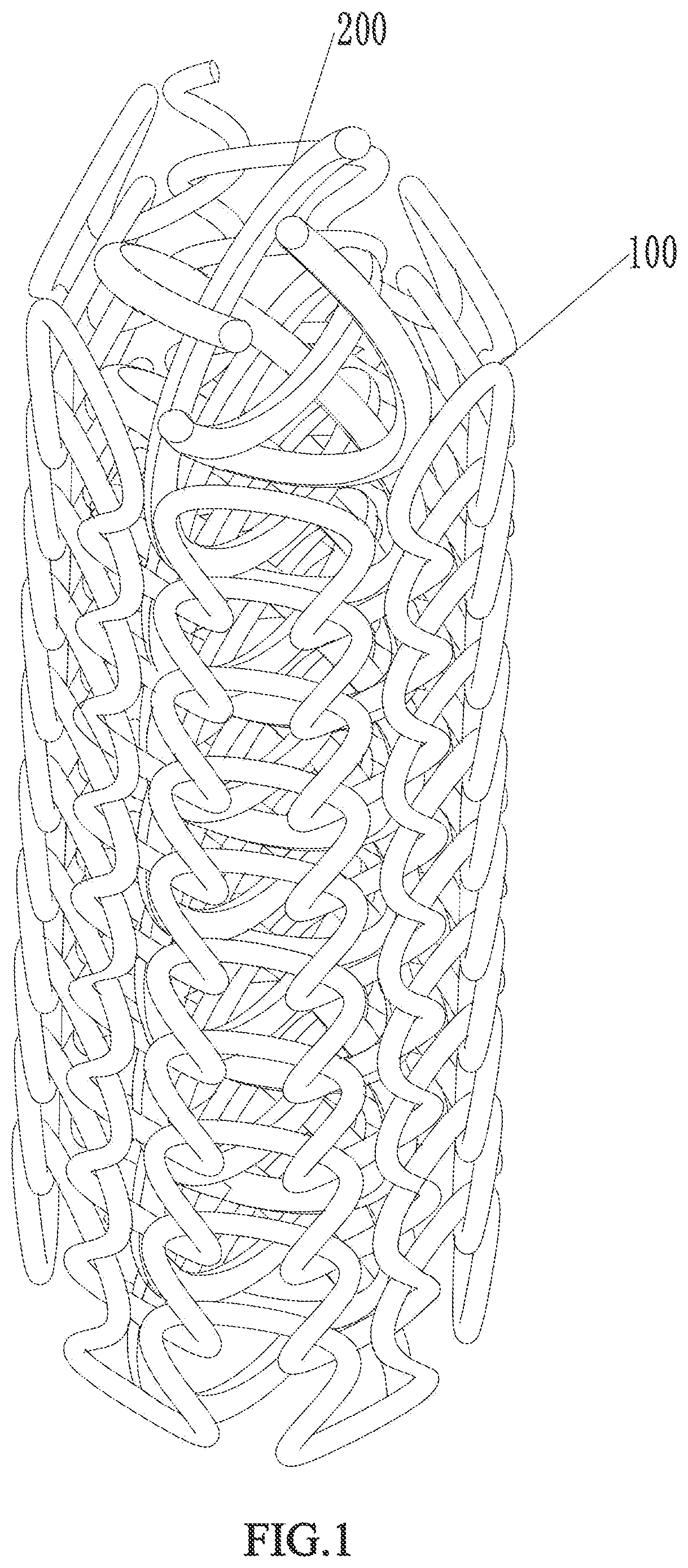 Patent US12569656 — Ureteral stent and manufacturing method thereof — Figure 1