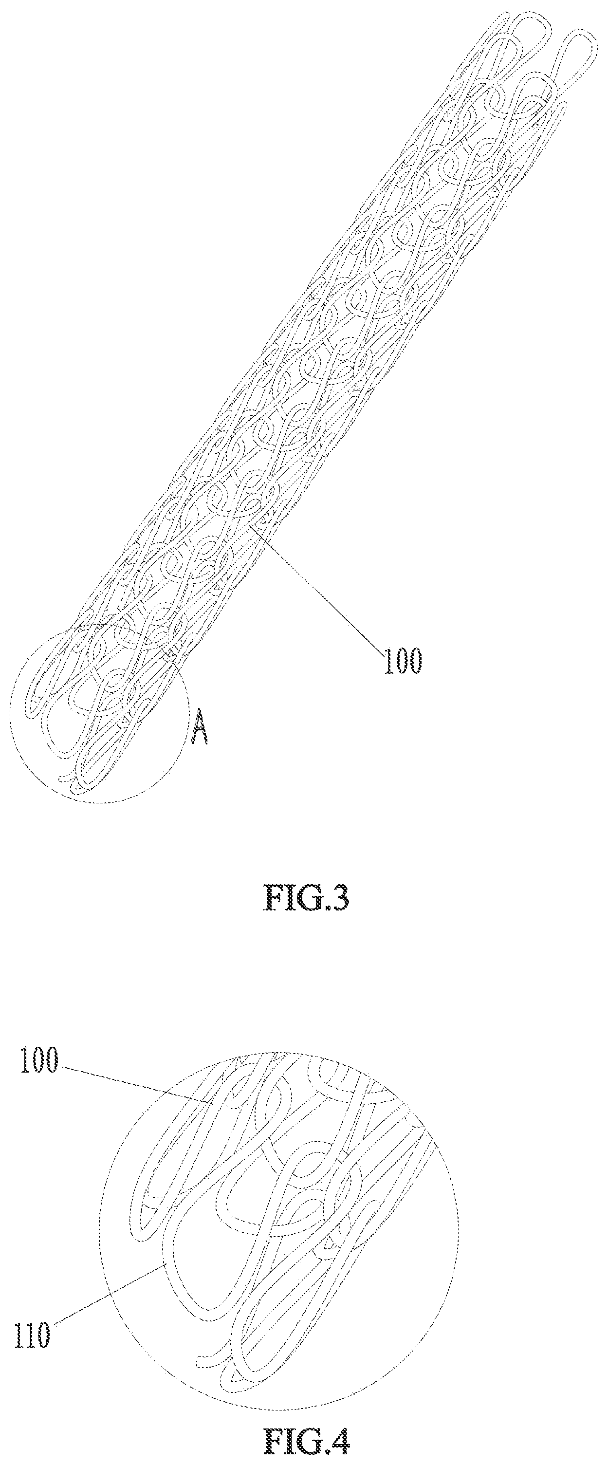 Patent US12569656 Figure 3 – Ureteral stent and manufacturing method thereof