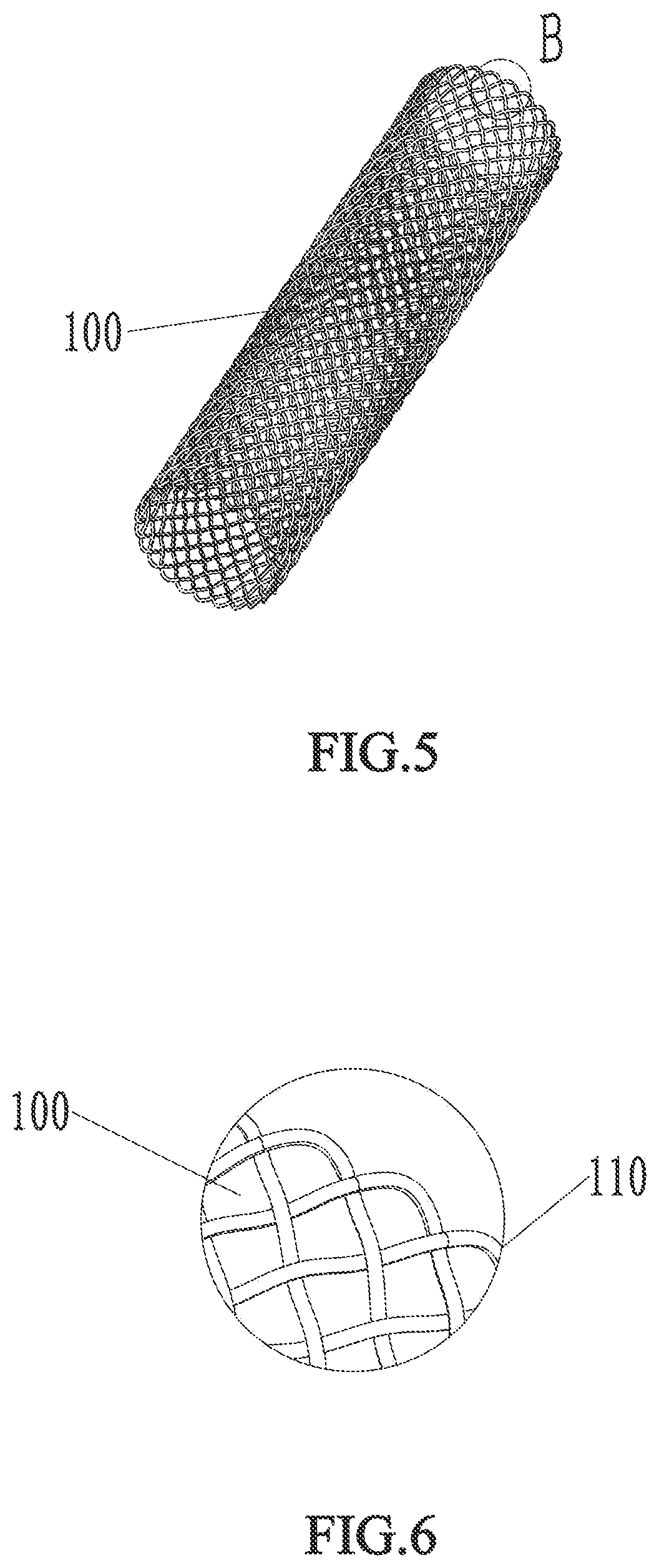 Patent US12569656 Figure 4 – Ureteral stent and manufacturing method thereof
