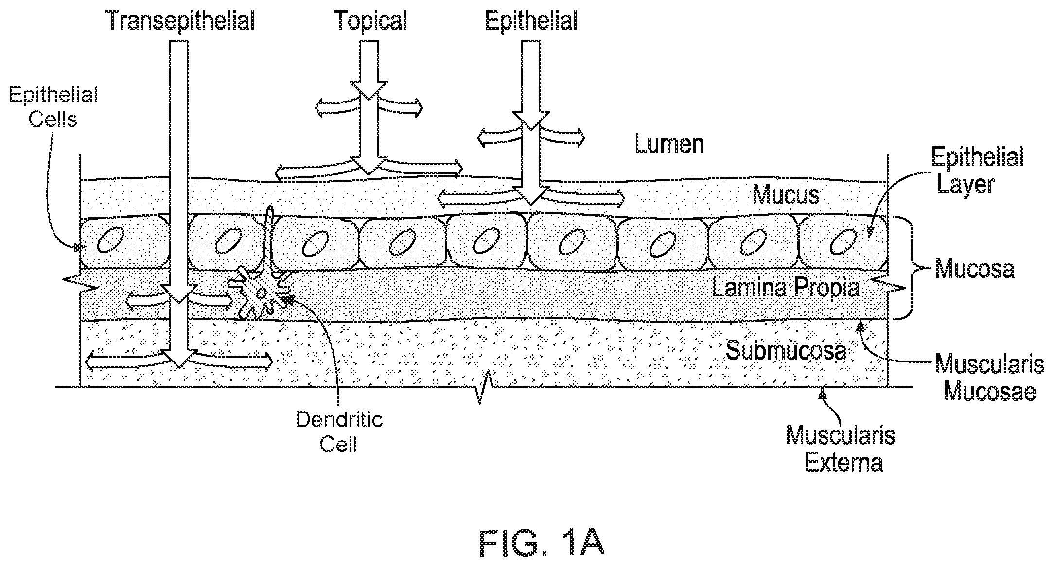 Patent US12569659 Figure 1 – Ingestible device for delivery of therapeutic agent to the gastrointestinal tract