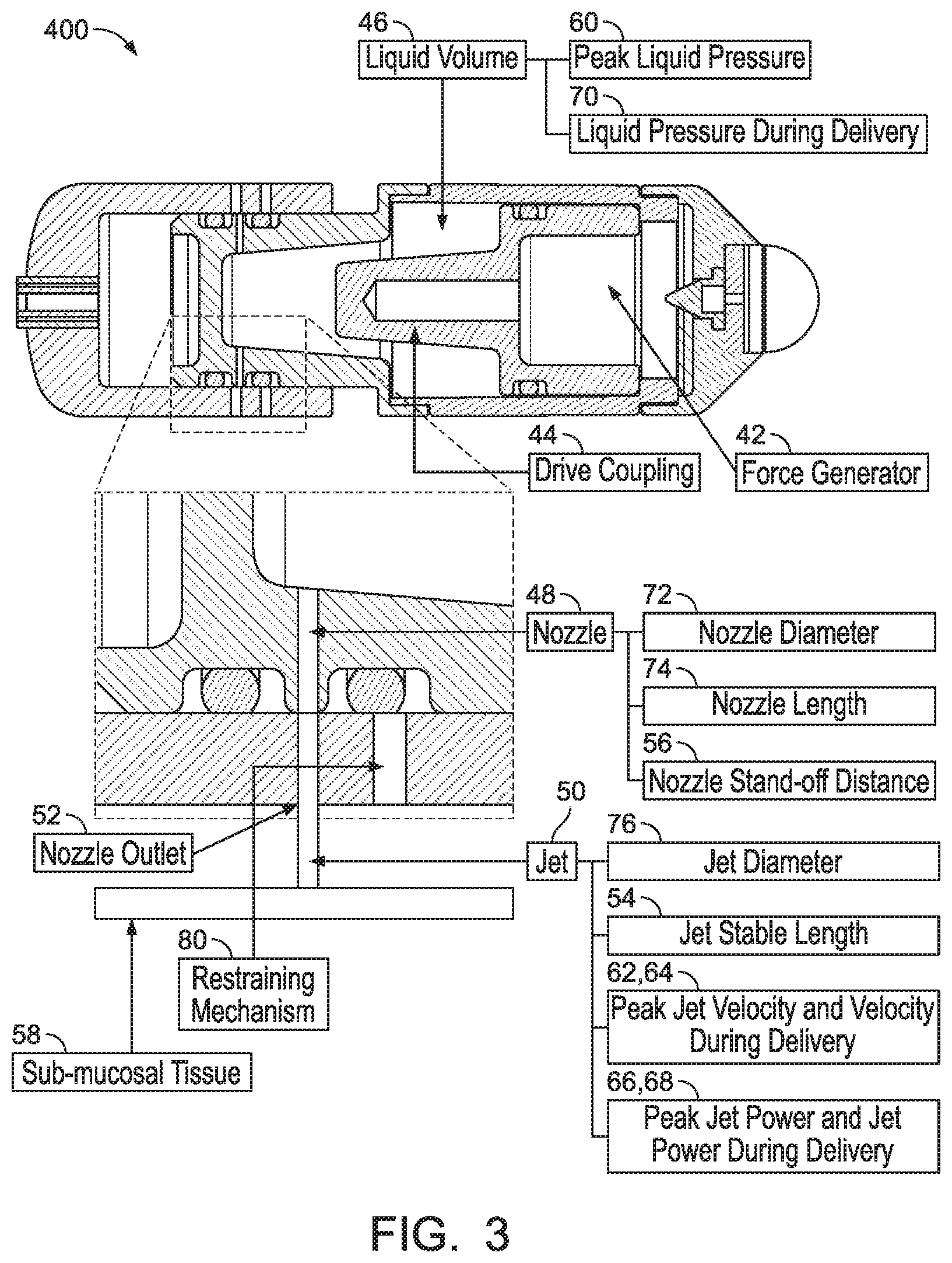 Patent US12569659 Figure 4 – Ingestible device for delivery of therapeutic agent to the gastrointestinal tract