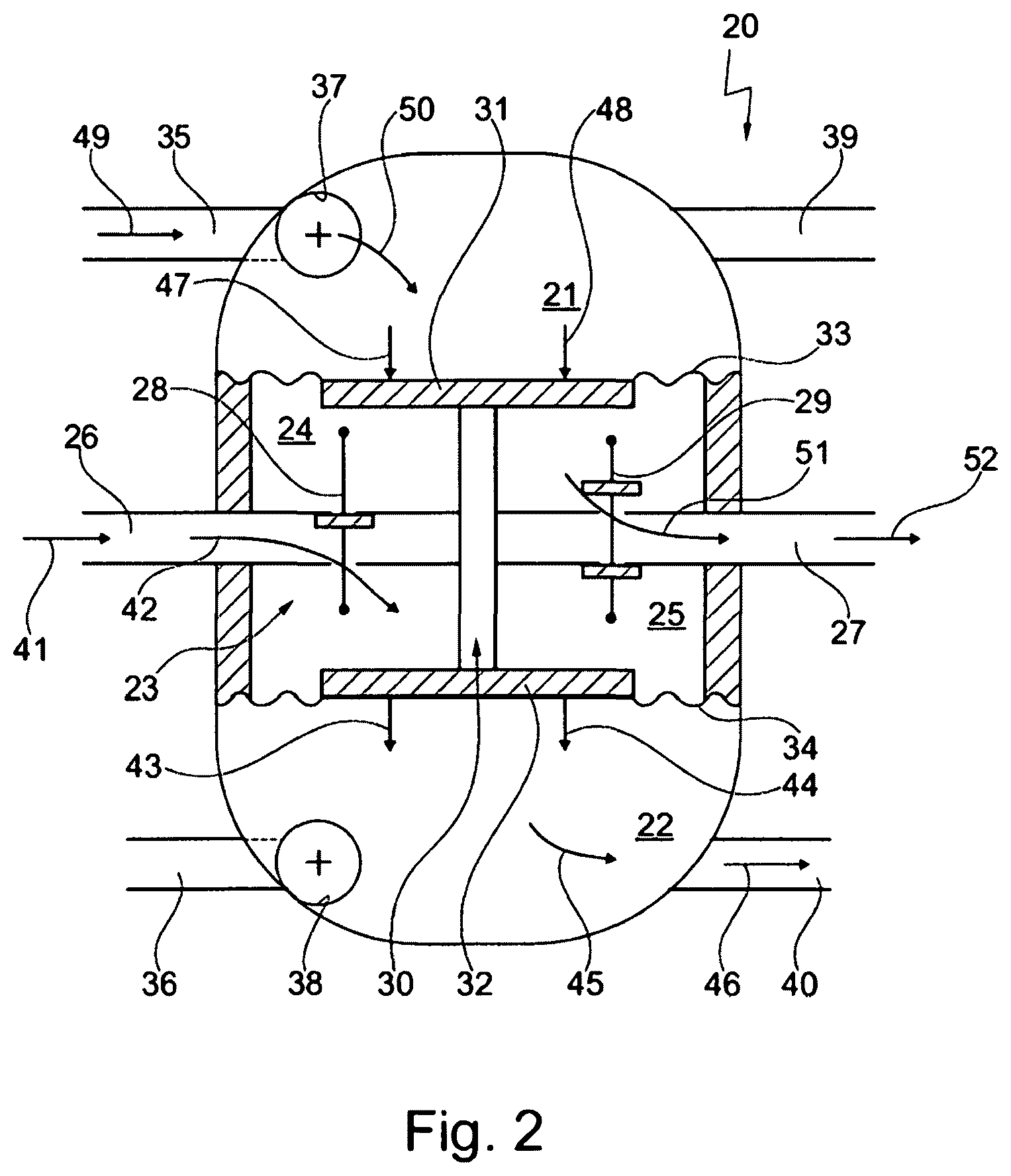 Patent US12569665 Figure 2 – Extracorporeal blood pump, heart-lung machine, method for operating an extracorporeal blood pump, and method for operating a heart-lung machine