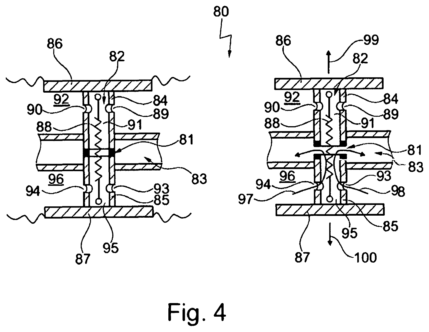 Patent US12569665 Figure 4 – Extracorporeal blood pump, heart-lung machine, method for operating an extracorporeal blood pump, and method for operating a heart-lung machine