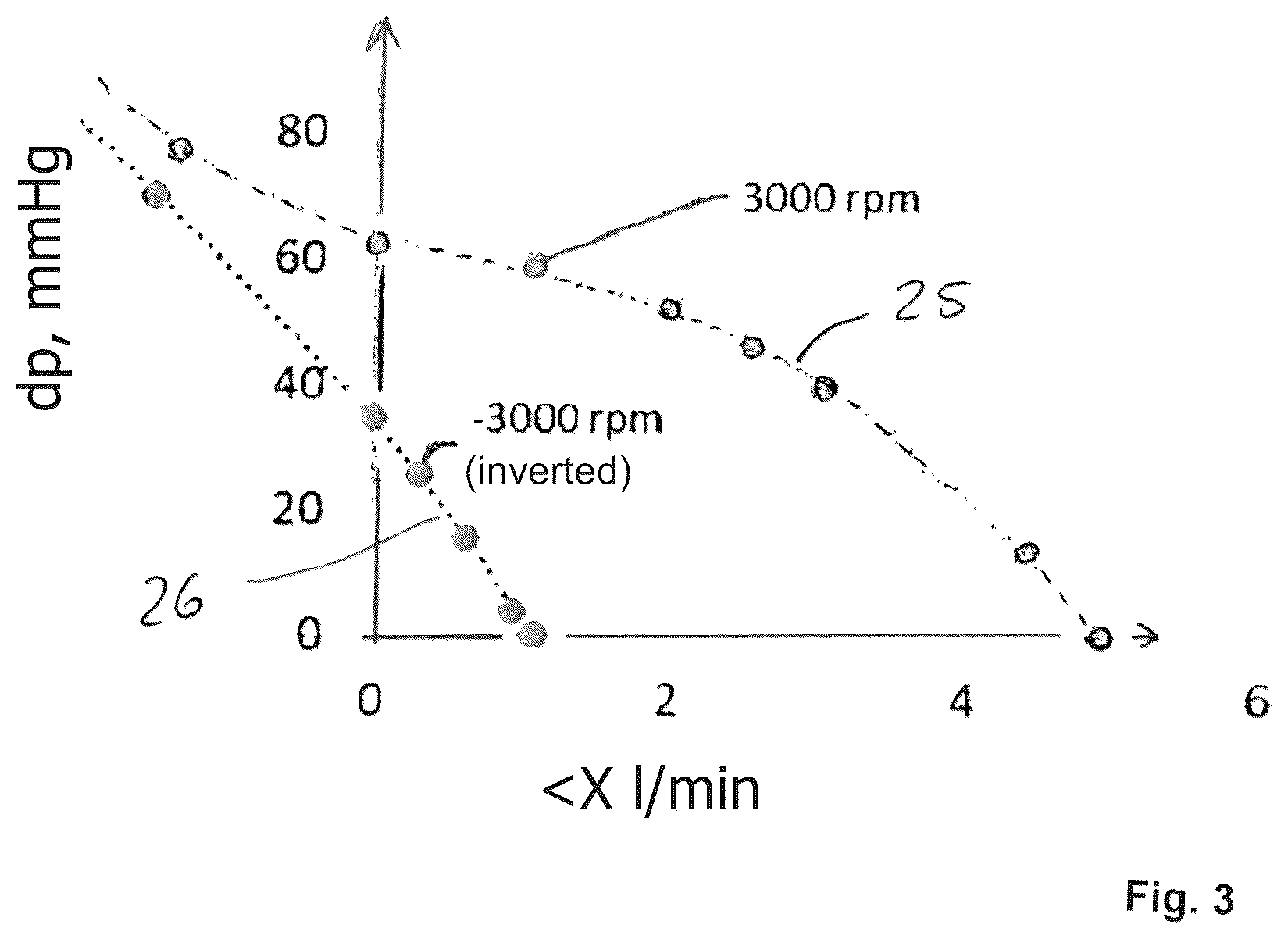 Patent US12569667 Figure 2 – Control unit for operating a blood pump in different conveying modes