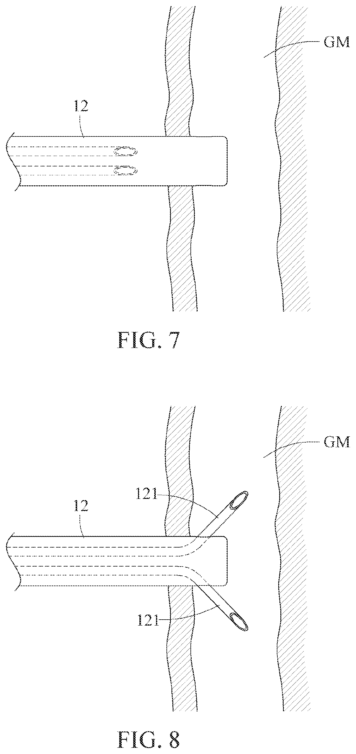 Patent US12569674 Figure 4 – Electrical stimulation system