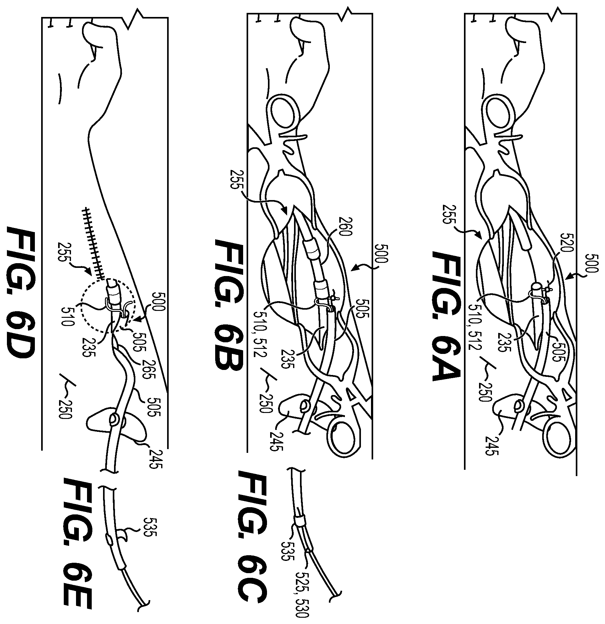 Patent US12569675 Figure 3 – Electrode apparatus for tissue stimulation and related method of use