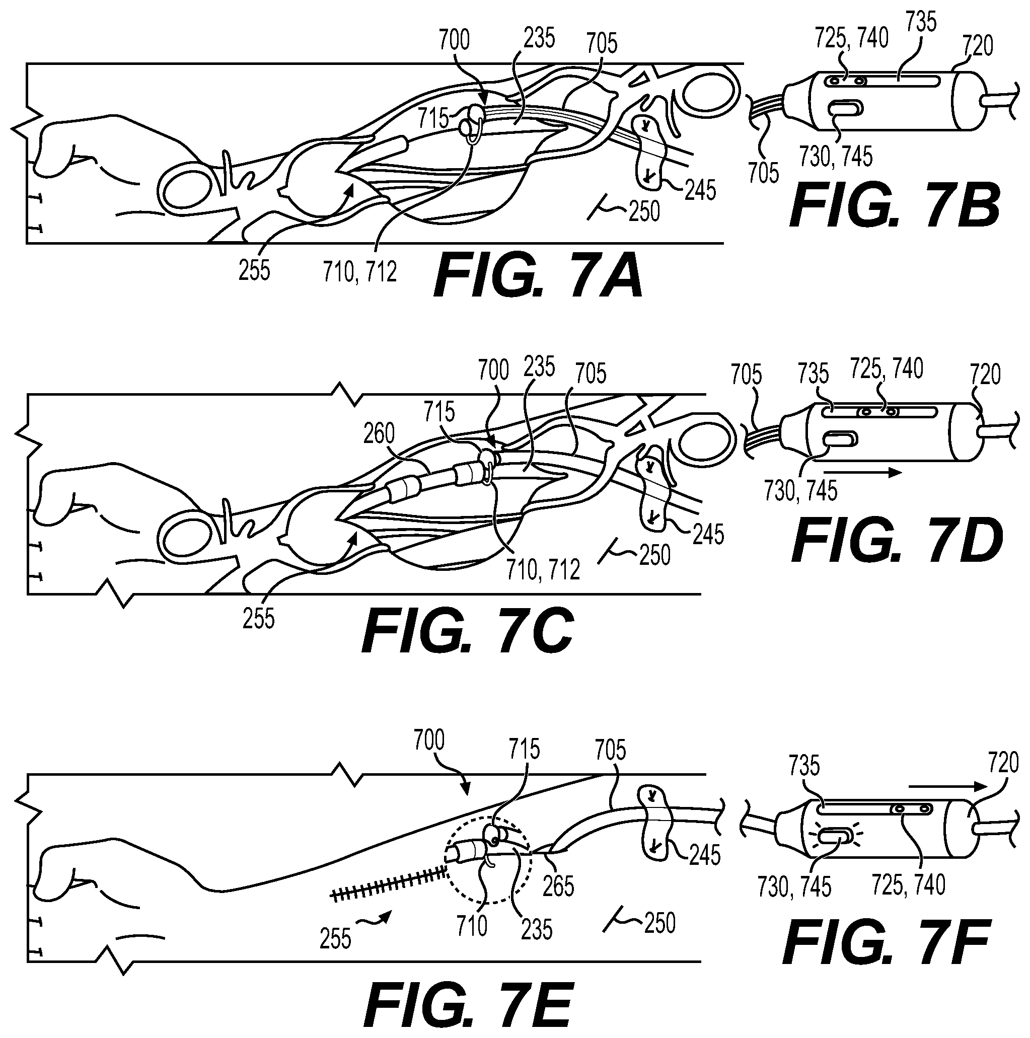 Patent US12569675 Figure 4 – Electrode apparatus for tissue stimulation and related method of use