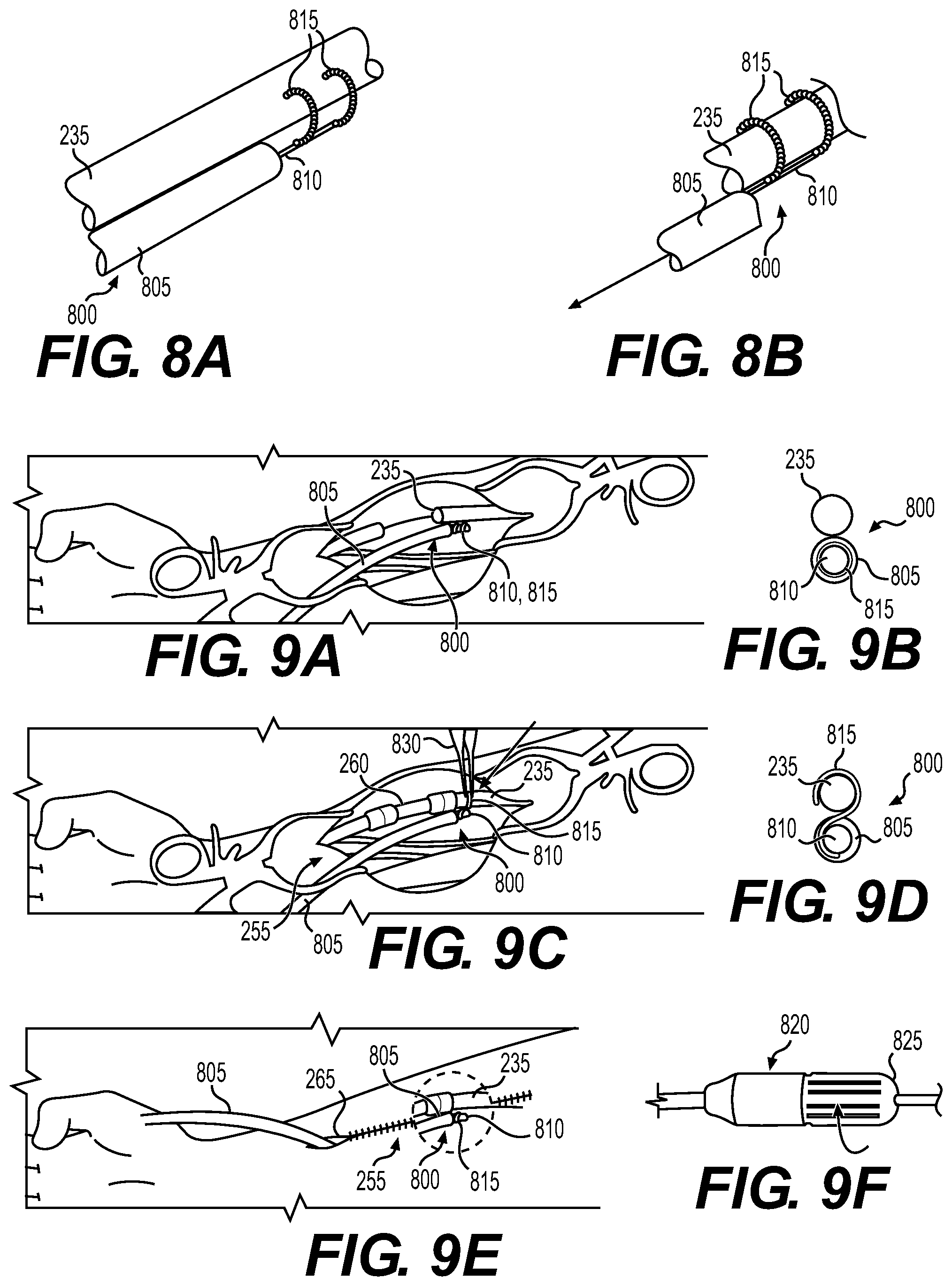 Patent US12569675 Figure 5 – Electrode apparatus for tissue stimulation and related method of use