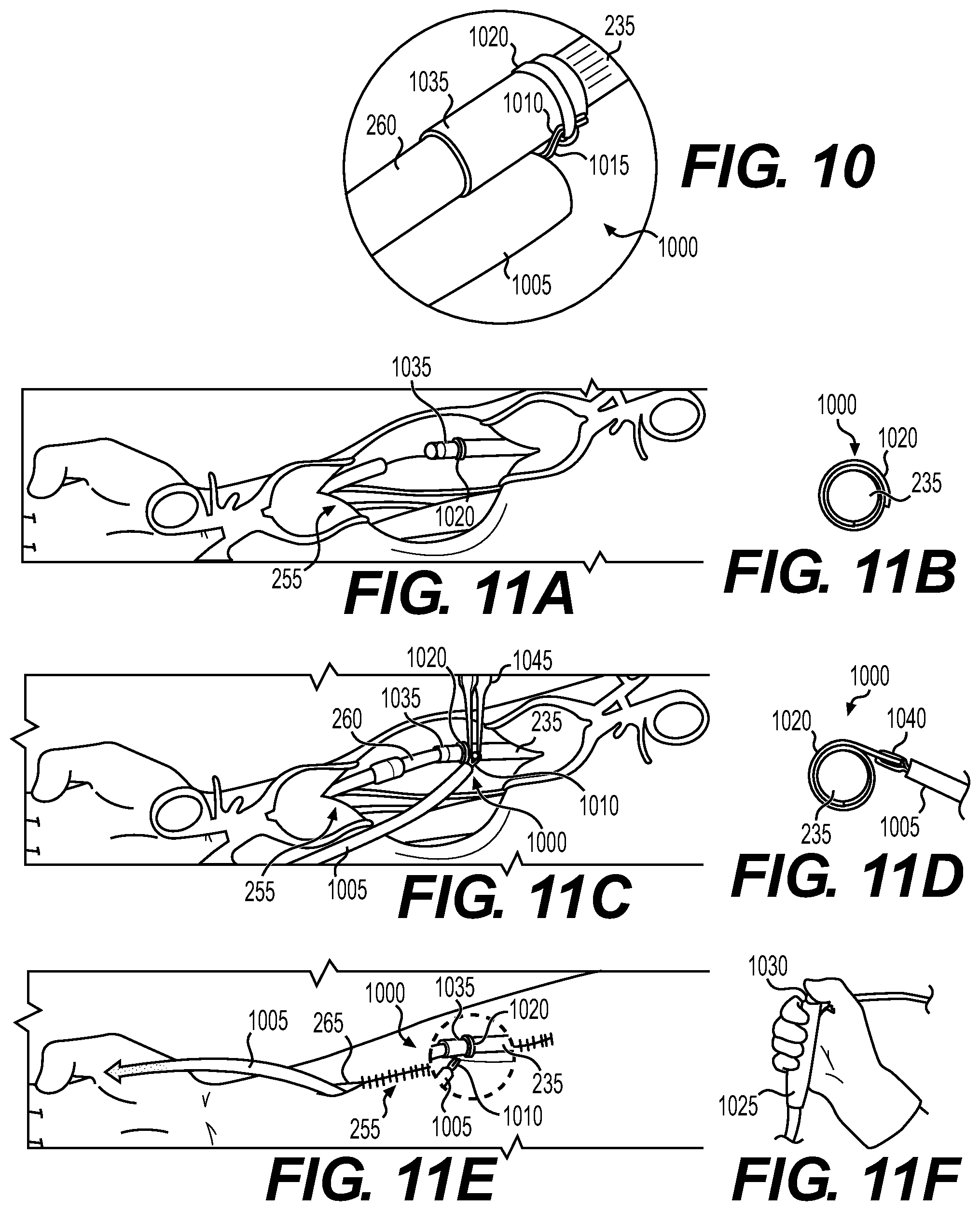 Patent US12569675 Figure 6 – Electrode apparatus for tissue stimulation and related method of use
