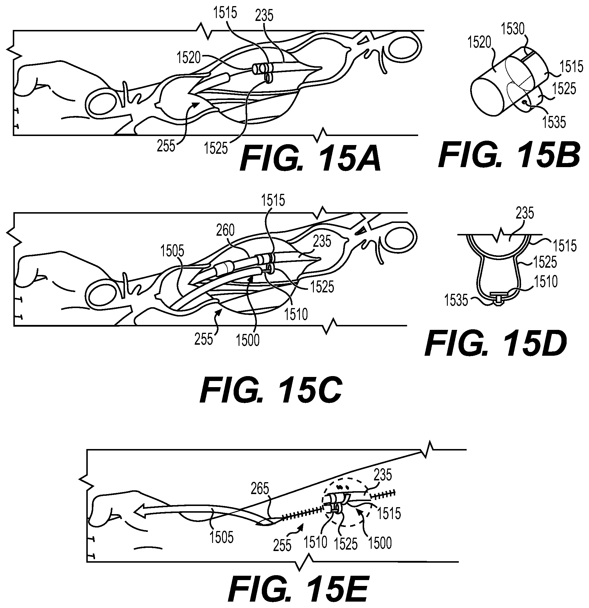 Patent US12569675 Figure 8 – Electrode apparatus for tissue stimulation and related method of use