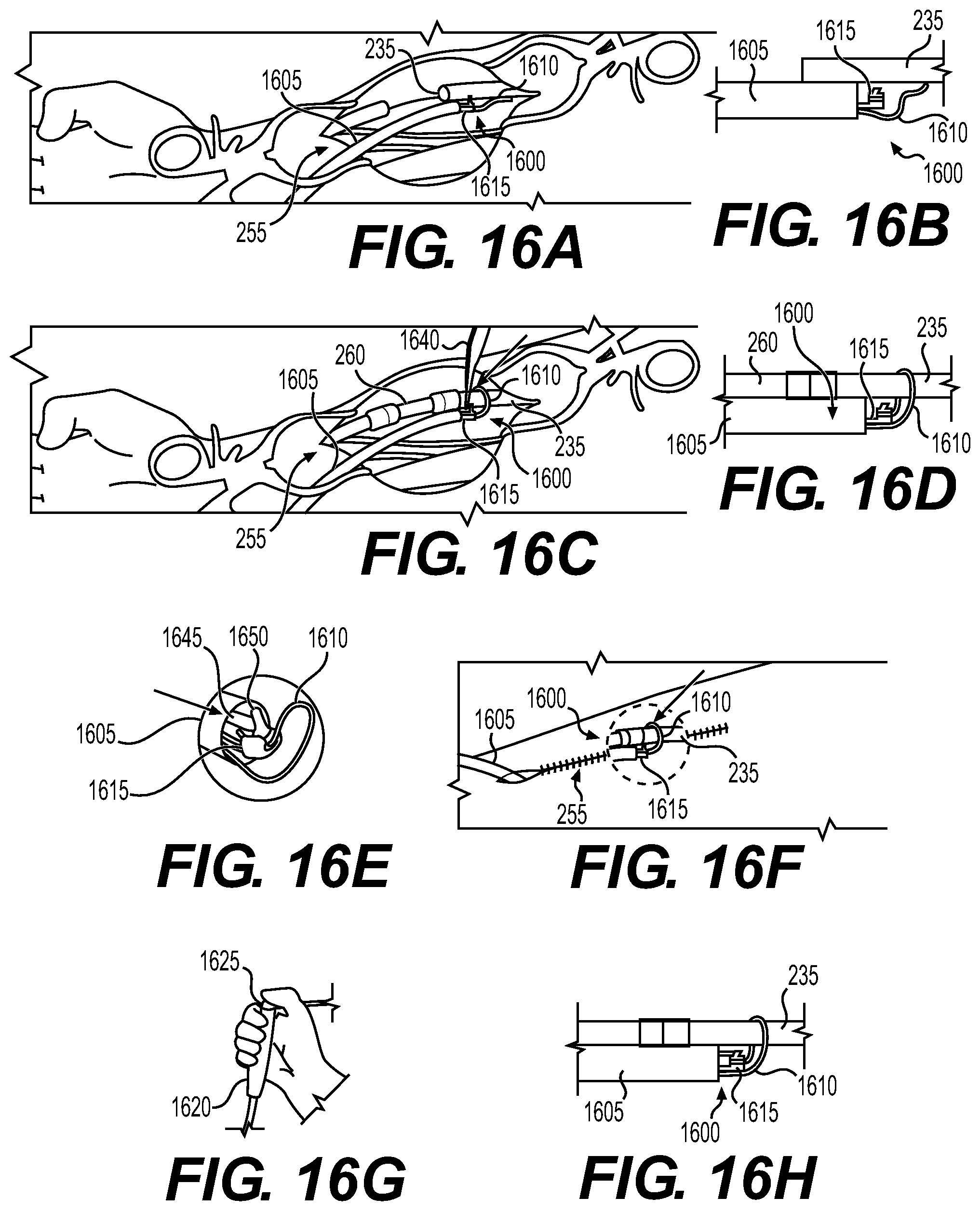 Patent US12569675 Figure 9 – Electrode apparatus for tissue stimulation and related method of use