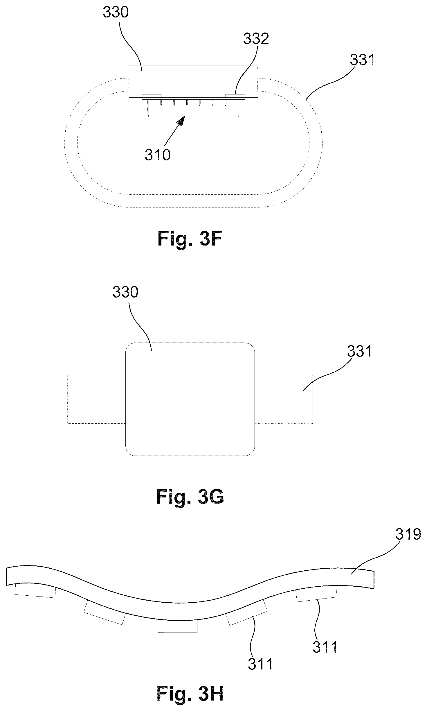 Patent US12569679 Figure 5 – Treatment delivery system