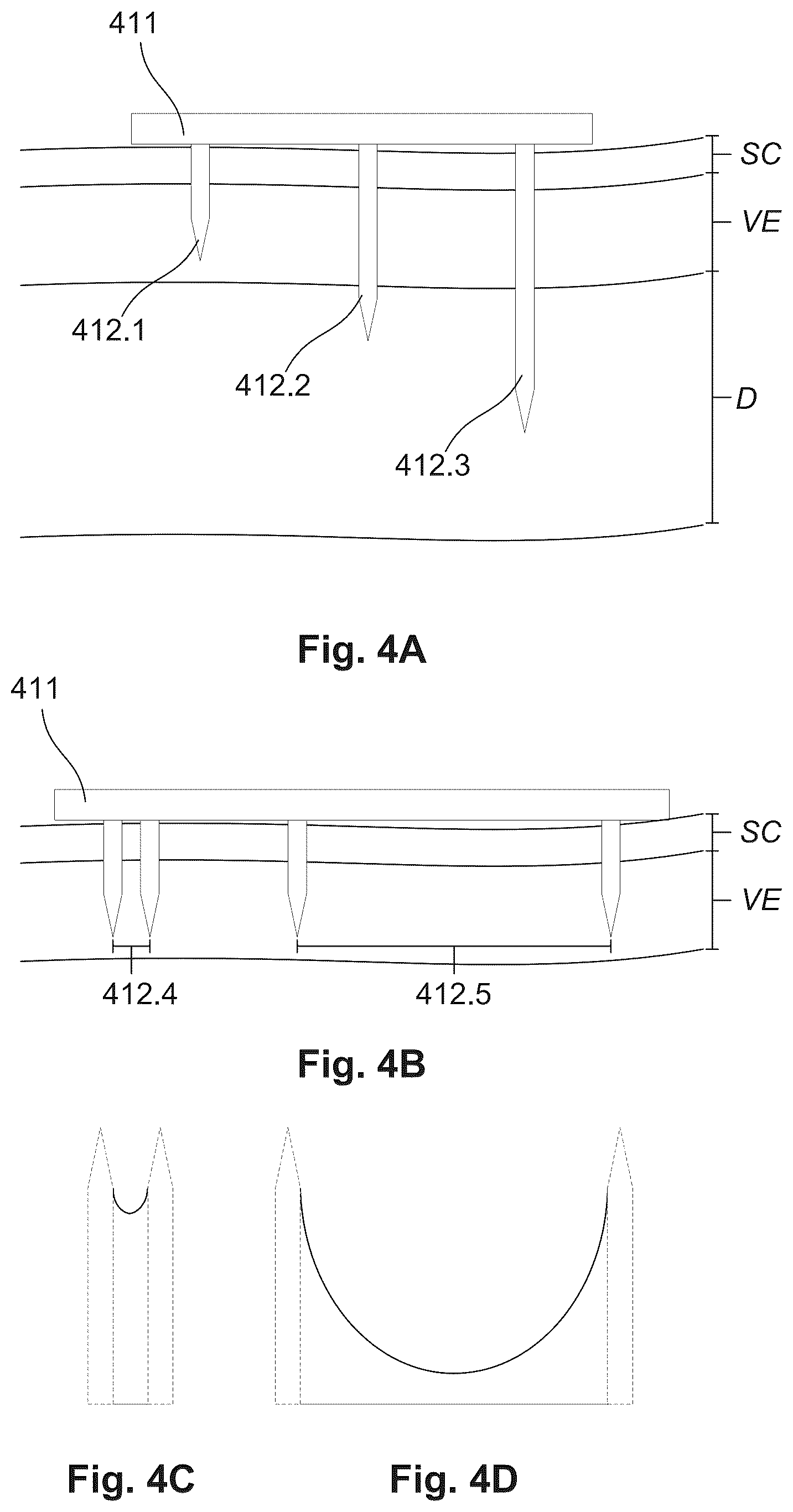 Patent US12569679 Figure 8 – Treatment delivery system