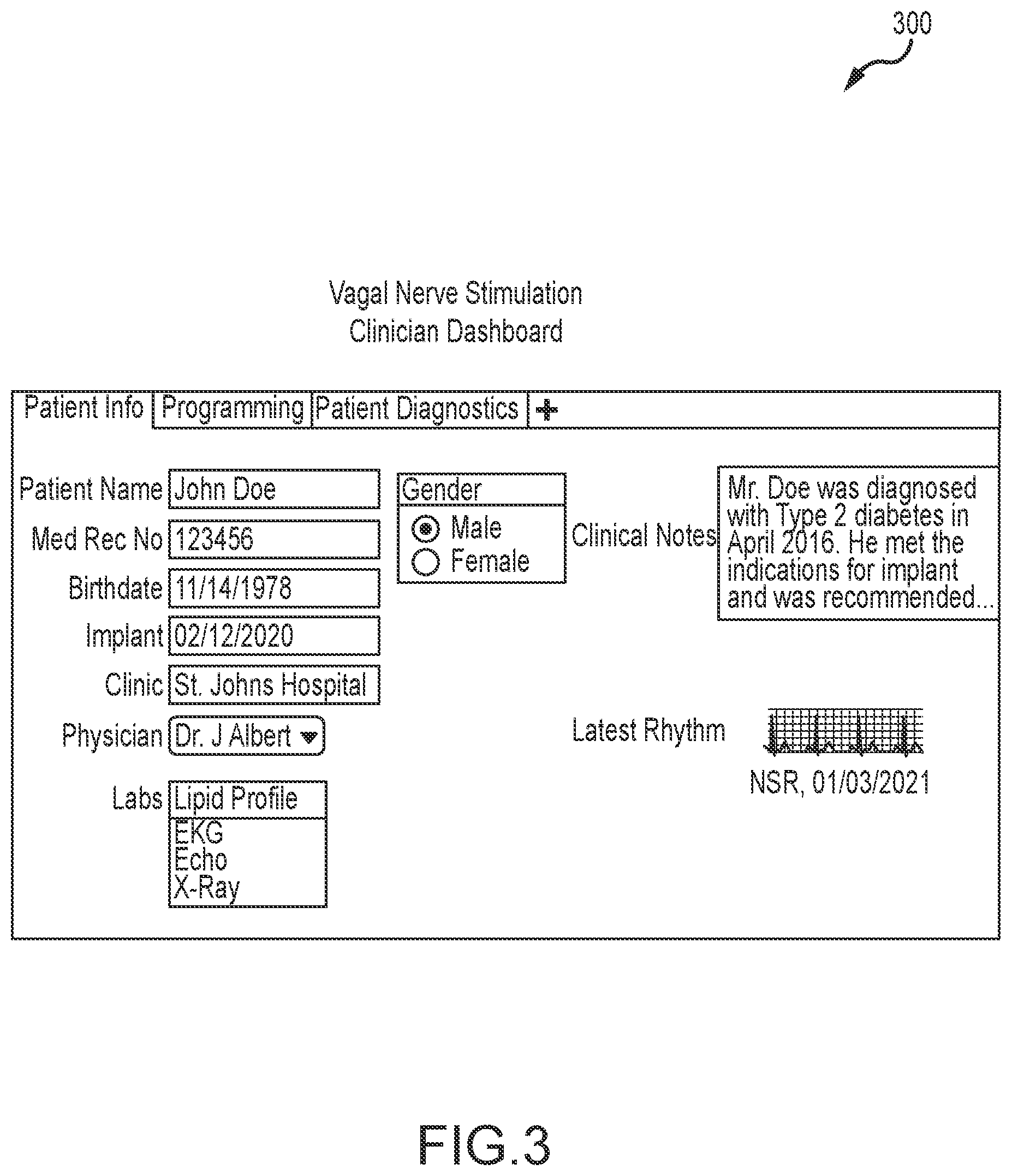 Patent US12569680 Figure 3 – Patient user interface for a stimulation/block therapy for treatment of type 2 diabetes