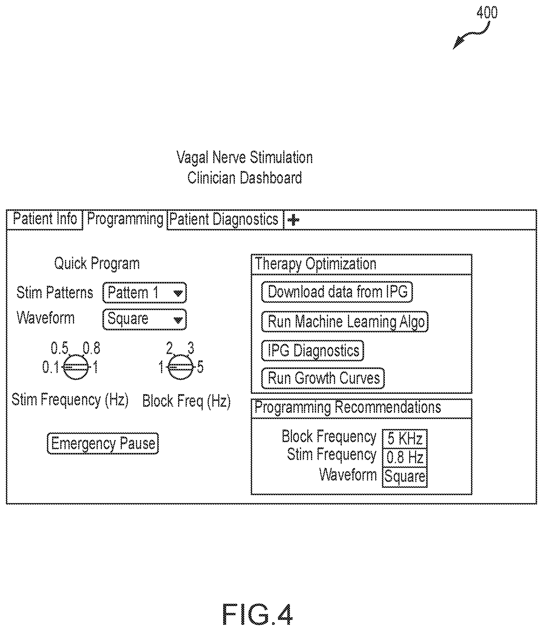Patent US12569680 Figure 4 – Patient user interface for a stimulation/block therapy for treatment of type 2 diabetes