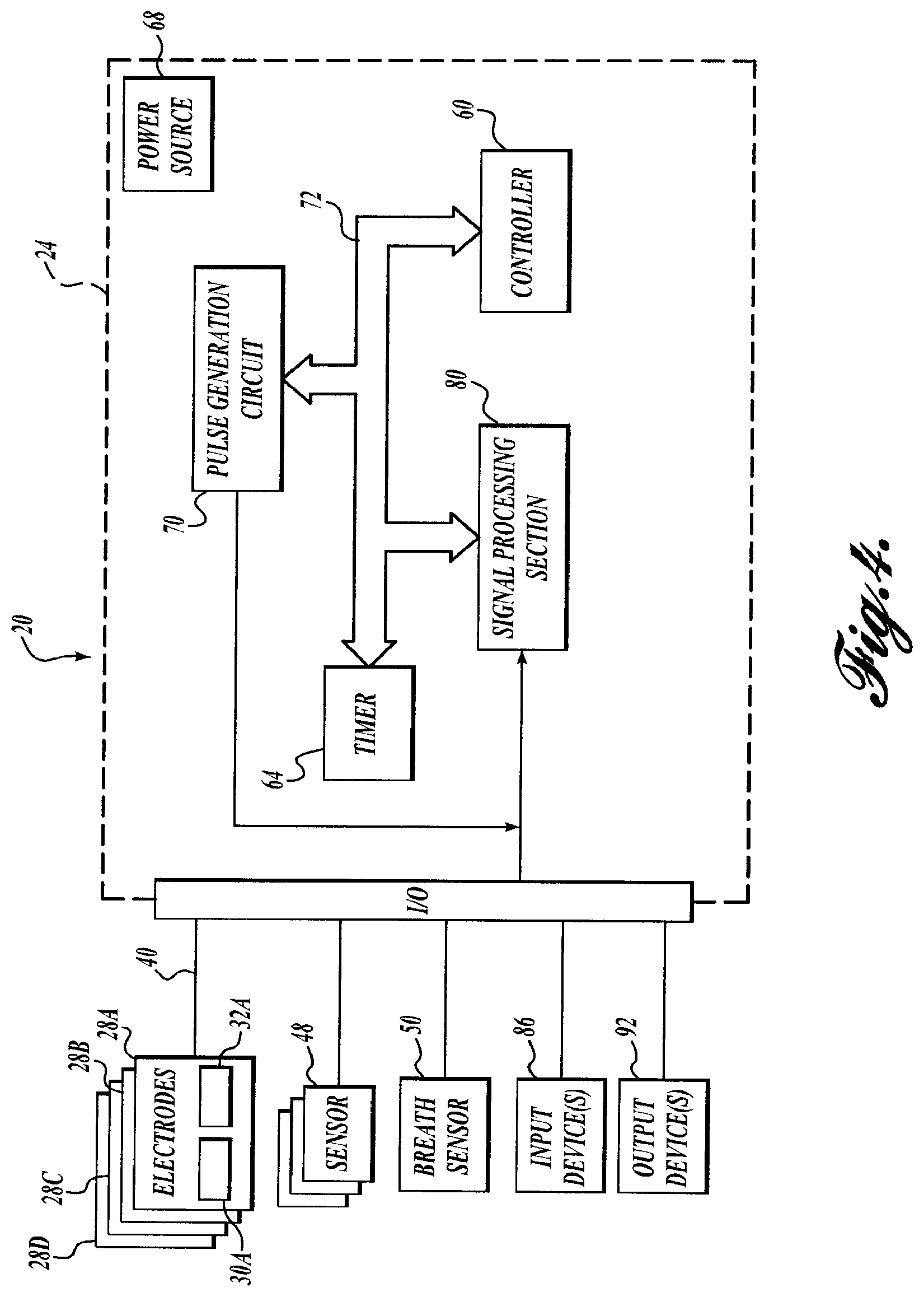 Patent US12569681 Figure 5 – Transvascular diaphragm pacing systems and methods of use