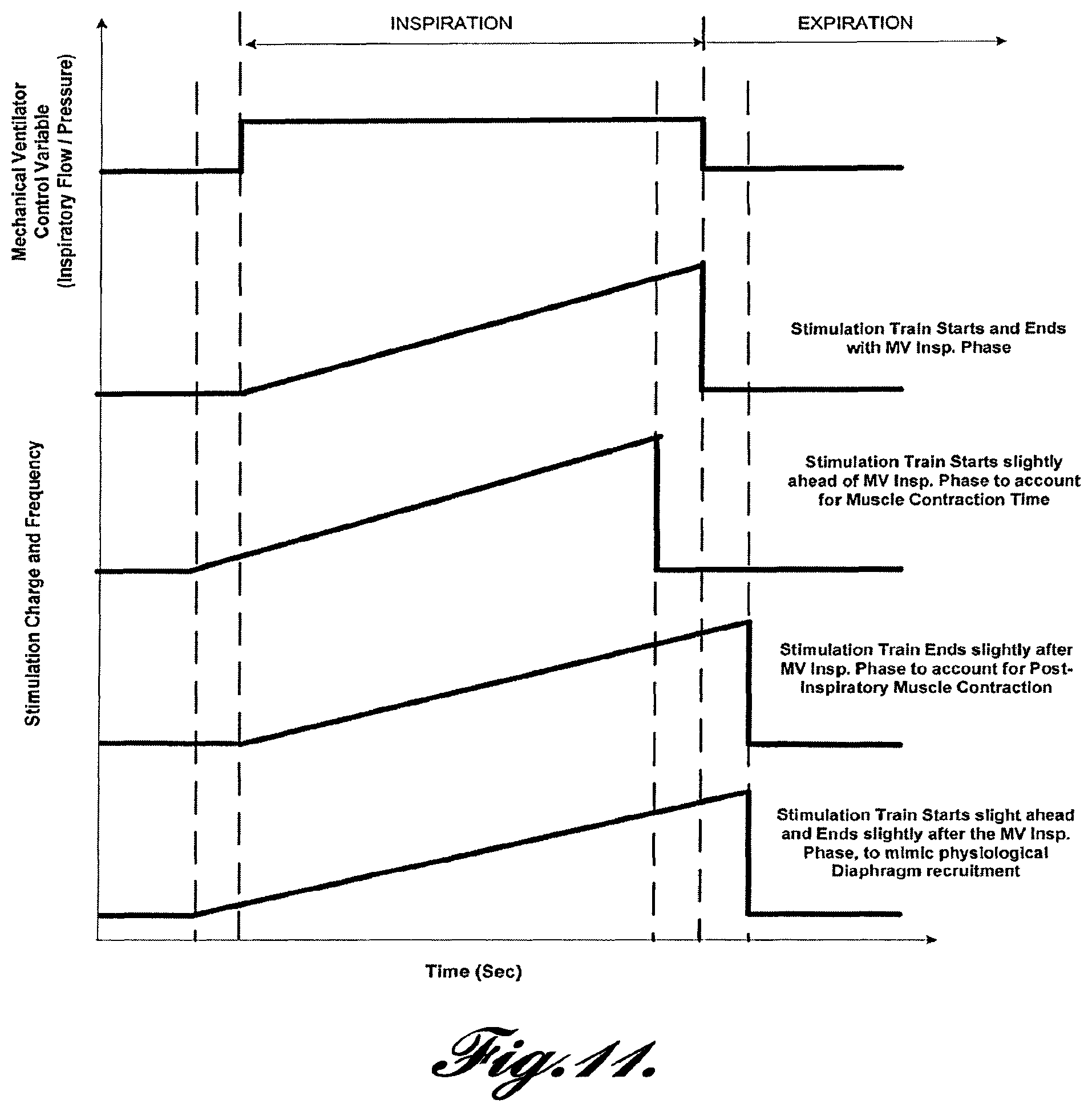 Patent US12569681 Figure 10 – Transvascular diaphragm pacing systems and methods of use