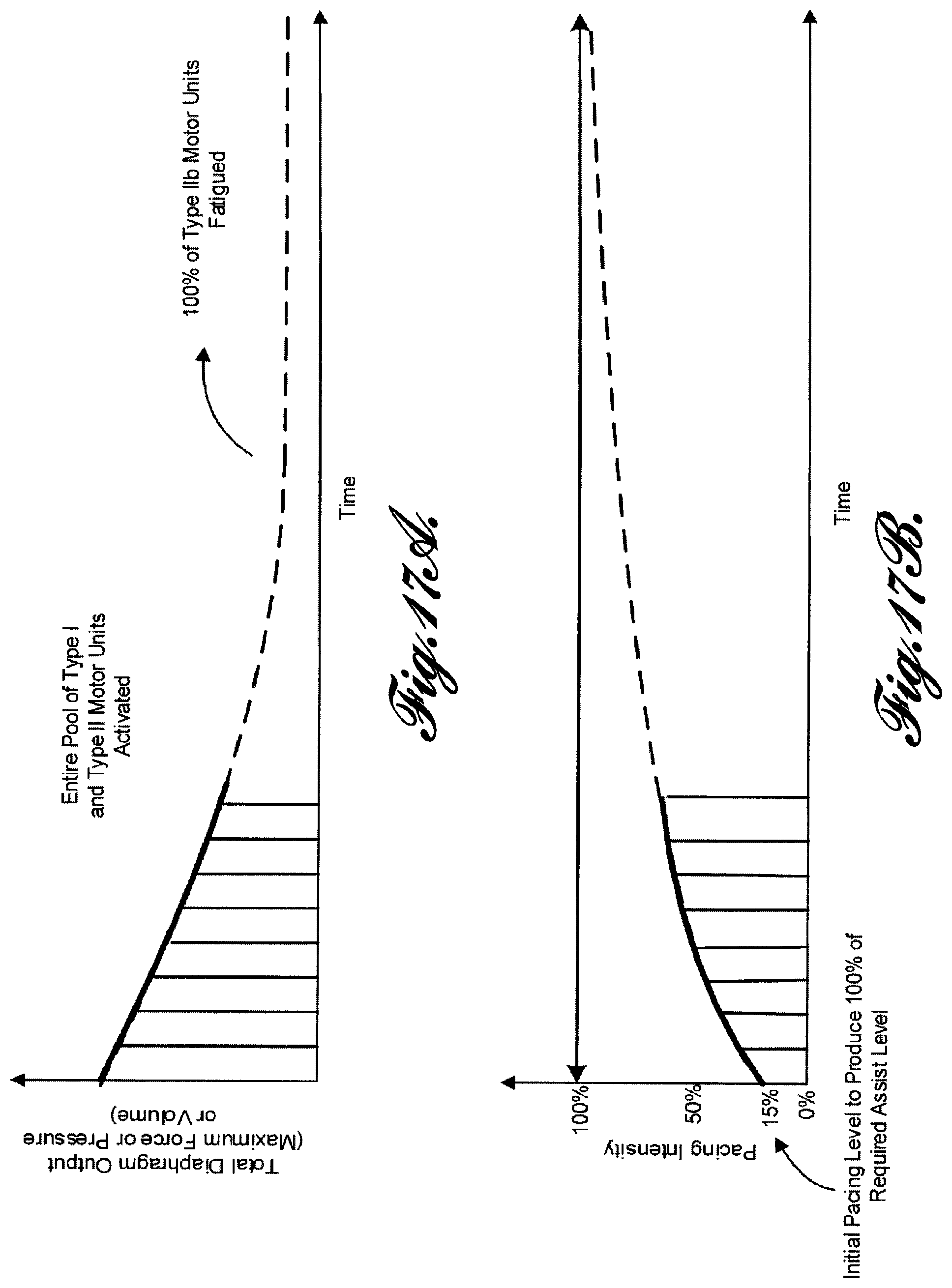 Patent US12569681 Figure 16 – Transvascular diaphragm pacing systems and methods of use