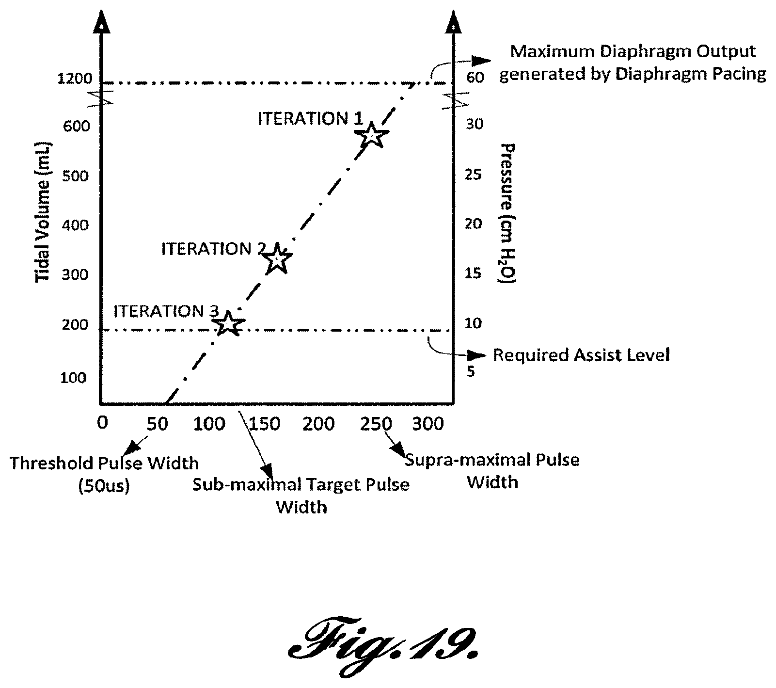 Patent US12569681 Figure 19 – Transvascular diaphragm pacing systems and methods of use