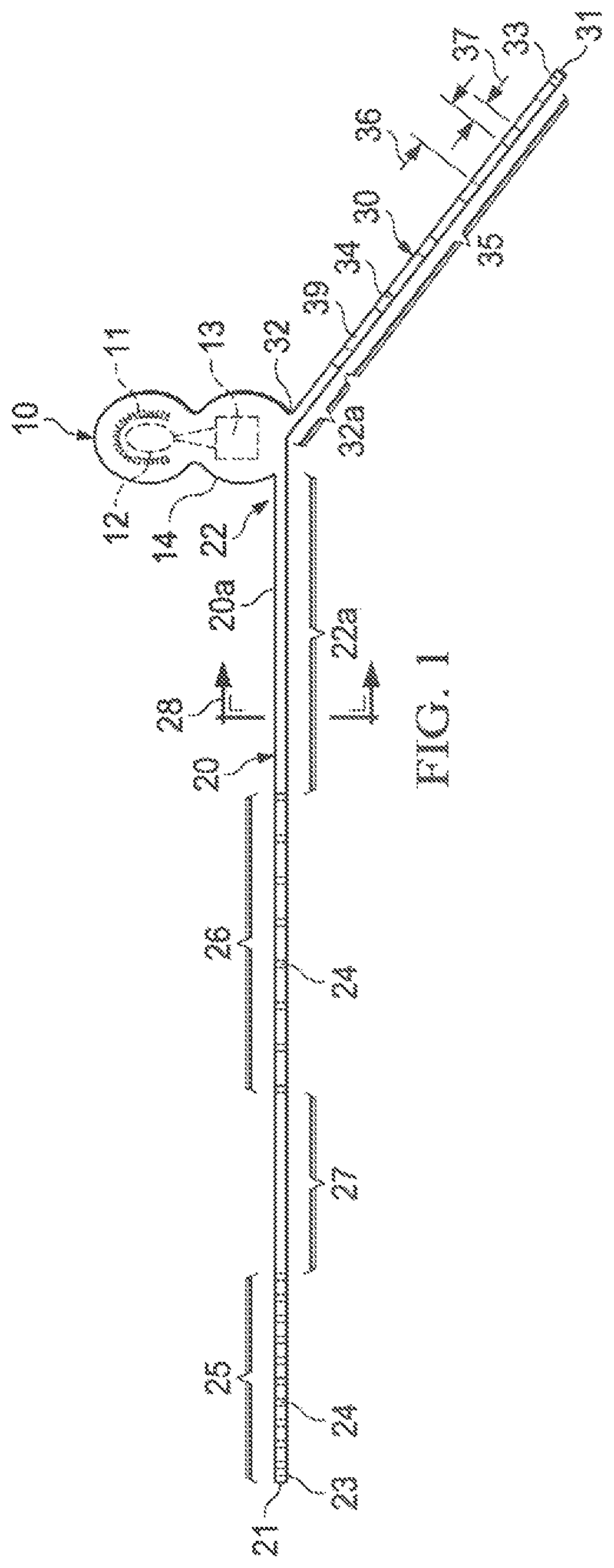 Patent US12569683 Figure 1 – Implantable head located radiofrequency coupled neurostimulation system for head pain