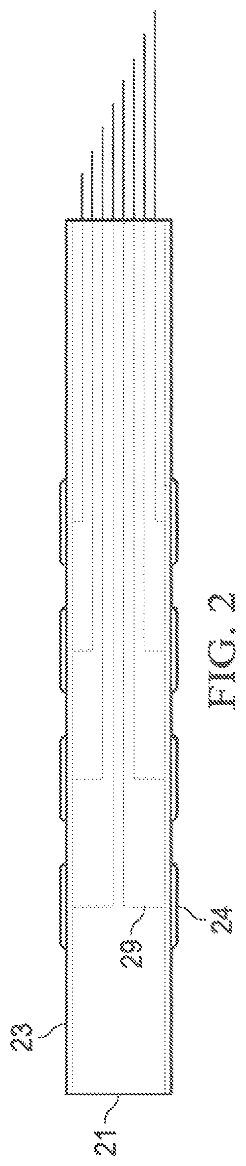 Patent US12569683 Figure 3 – Implantable head located radiofrequency coupled neurostimulation system for head pain