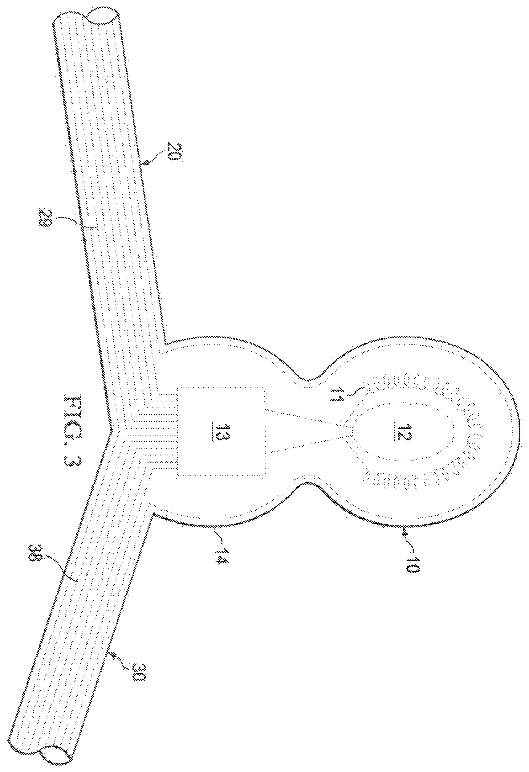 Patent US12569683 Figure 4 – Implantable head located radiofrequency coupled neurostimulation system for head pain