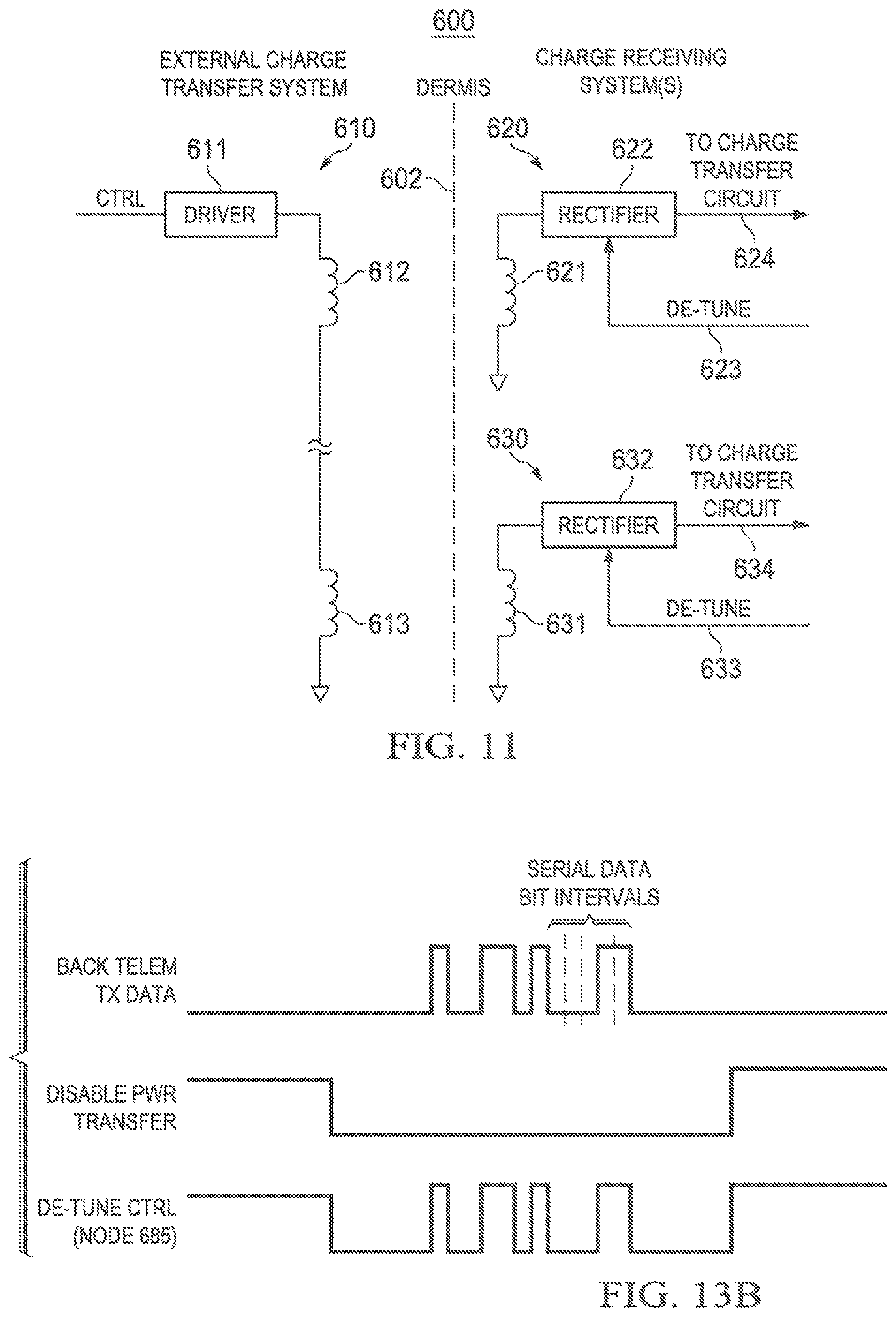Patent US12569683 Figure 12 – Implantable head located radiofrequency coupled neurostimulation system for head pain