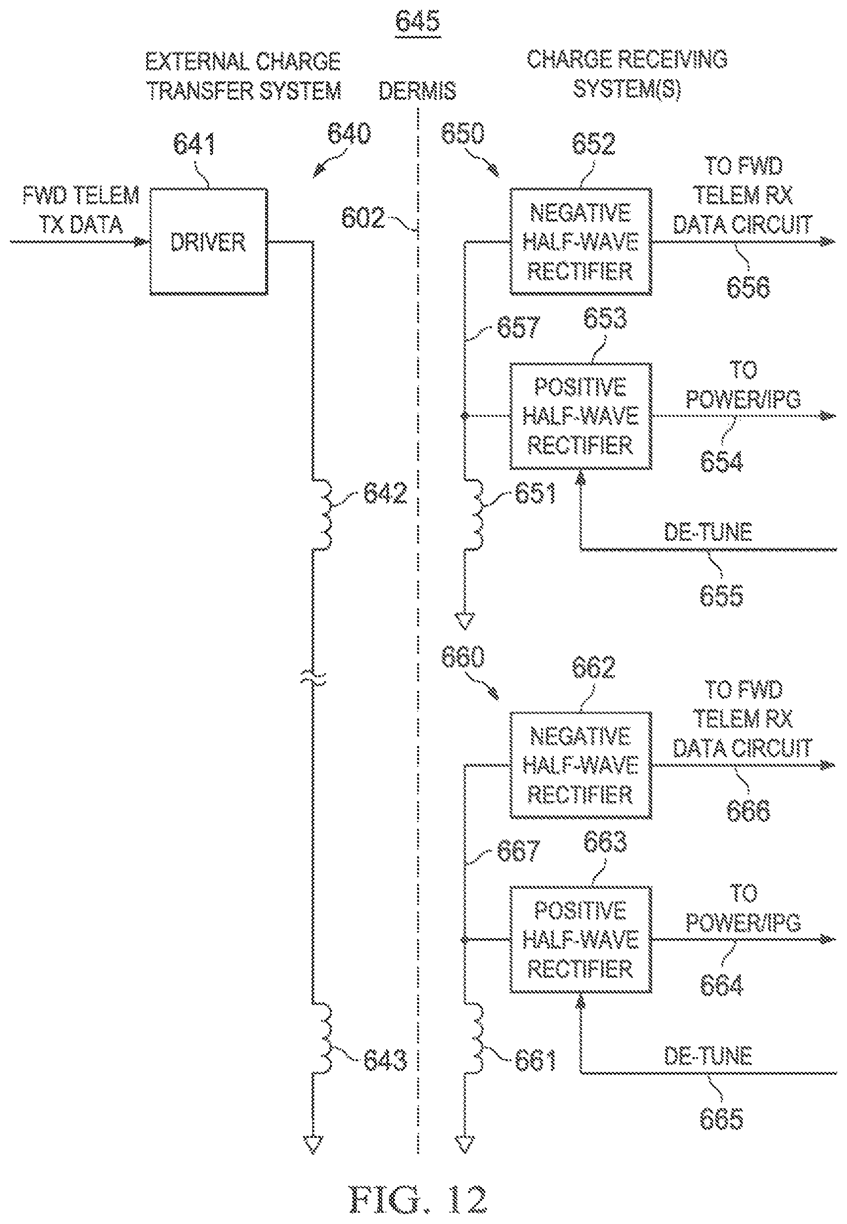 Patent US12569683 Figure 13 – Implantable head located radiofrequency coupled neurostimulation system for head pain