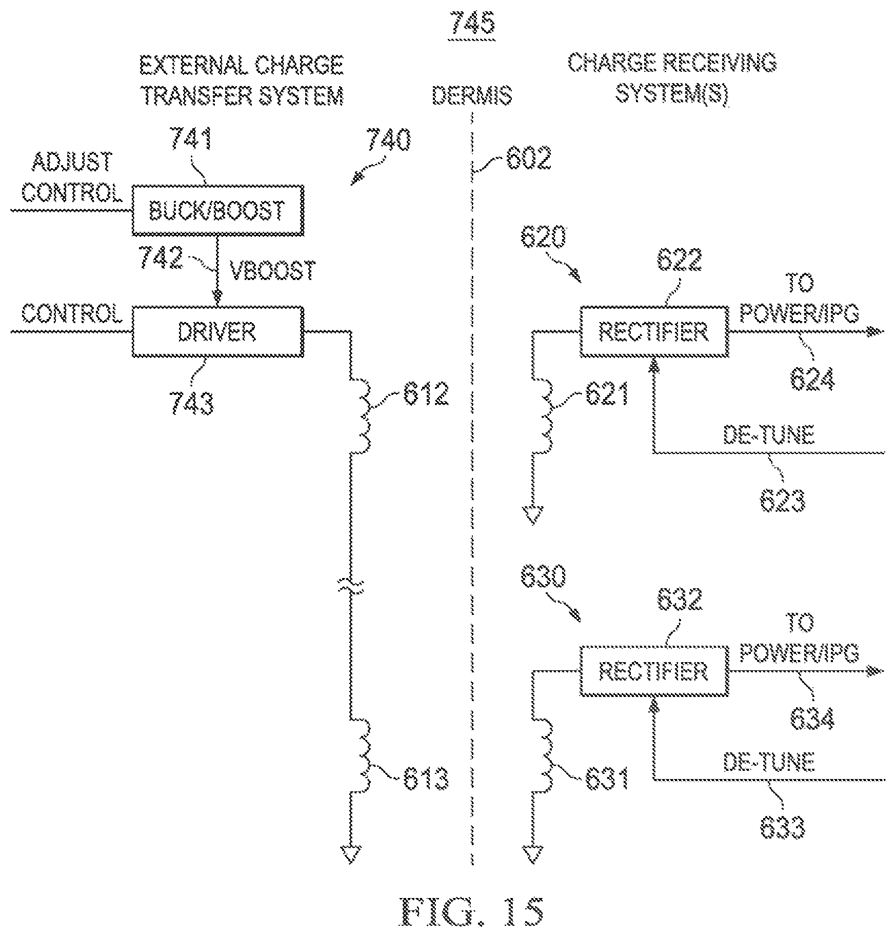 Patent US12569683 Figure 17 – Implantable head located radiofrequency coupled neurostimulation system for head pain