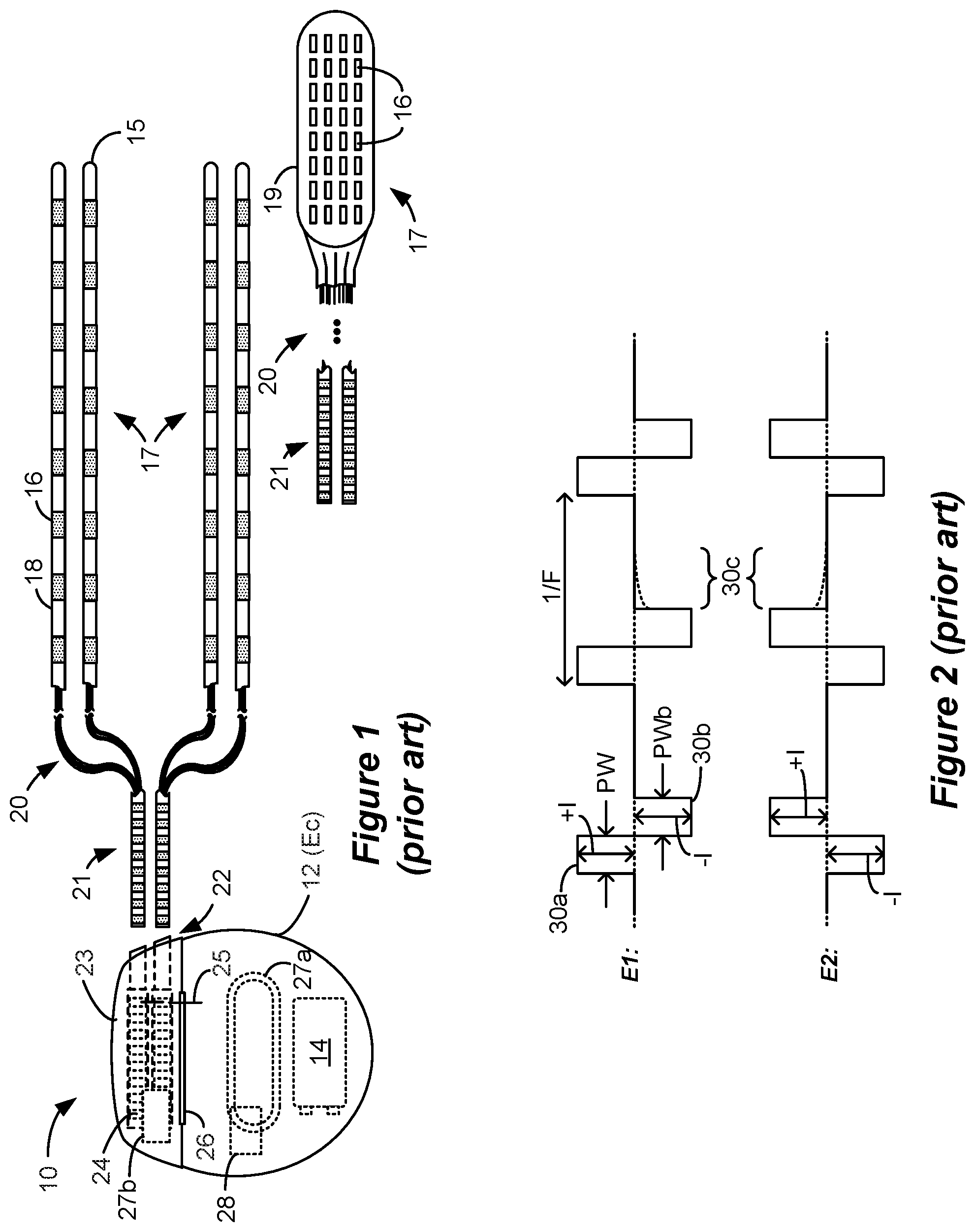 Patent US12569684 Figure 1 – Calibration of stimulation circuitry in an implantable stimulator device using sensed neural responses to stimulation
