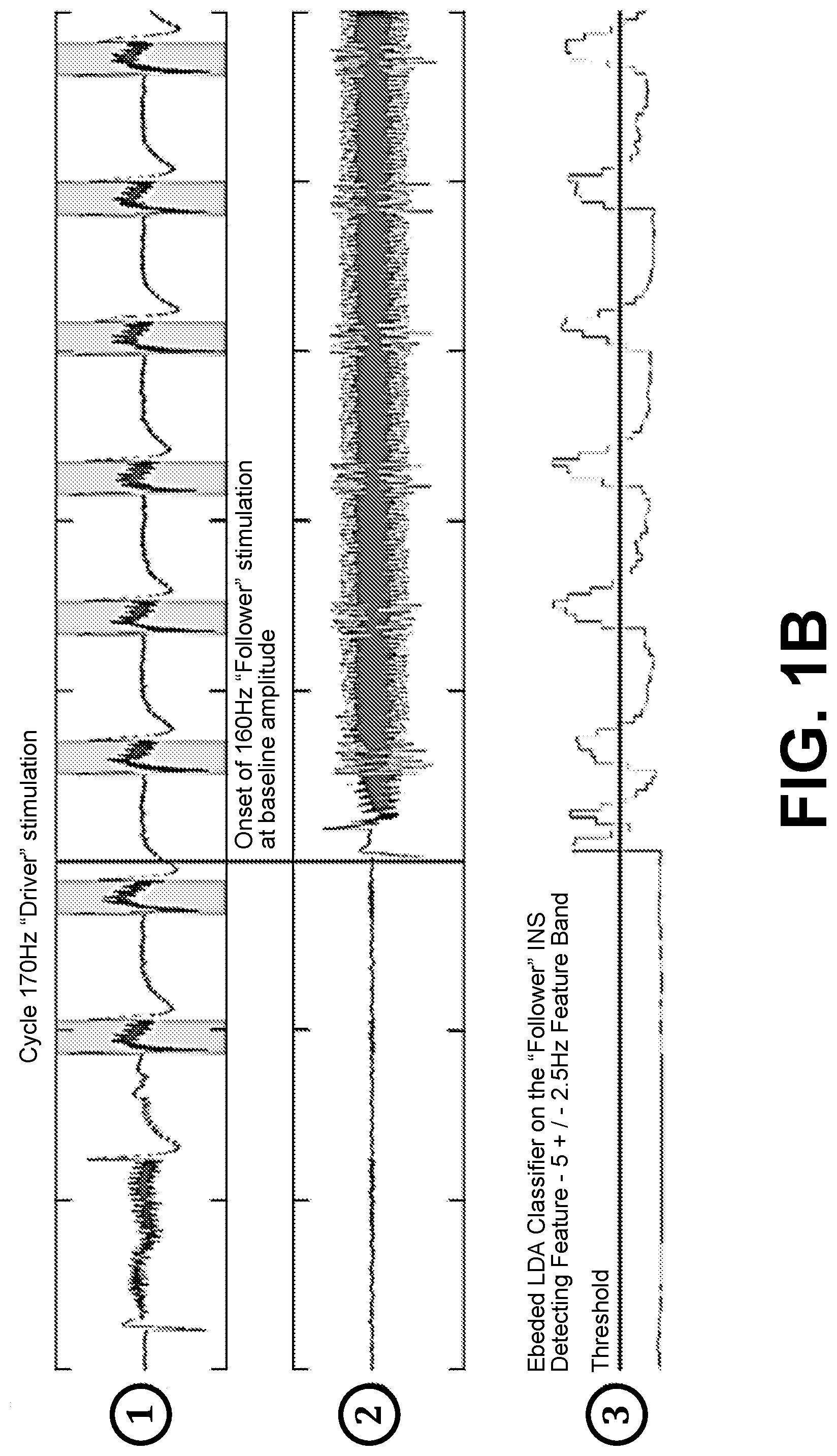 Patent US12569685 Figure 2 – Simultaneous bilateral stimulation using neurostimulator
