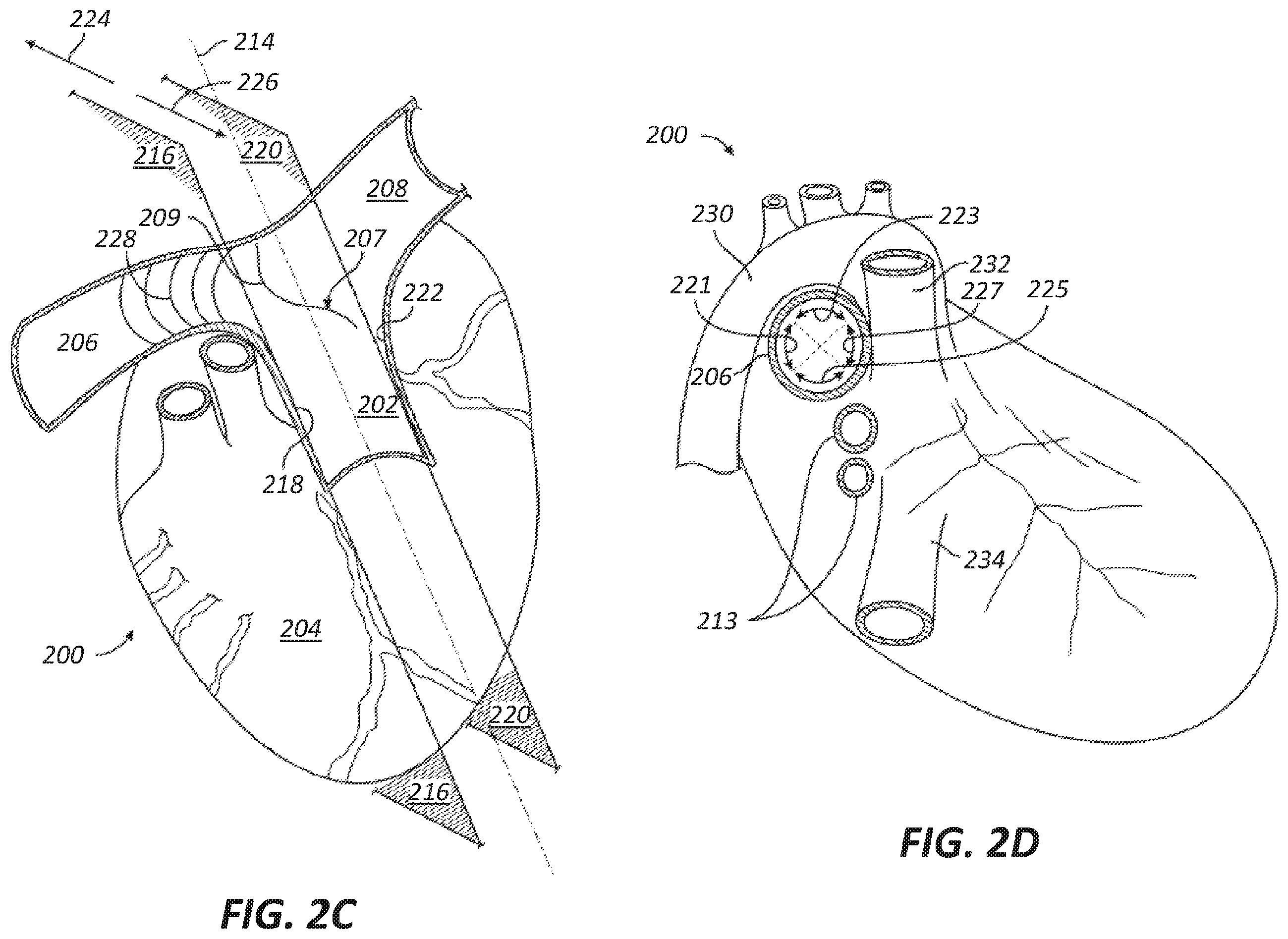 Patent US12569686 Figure 3 – Chronically implantable systems and methods for affecting cardiac contractility and/or relaxation