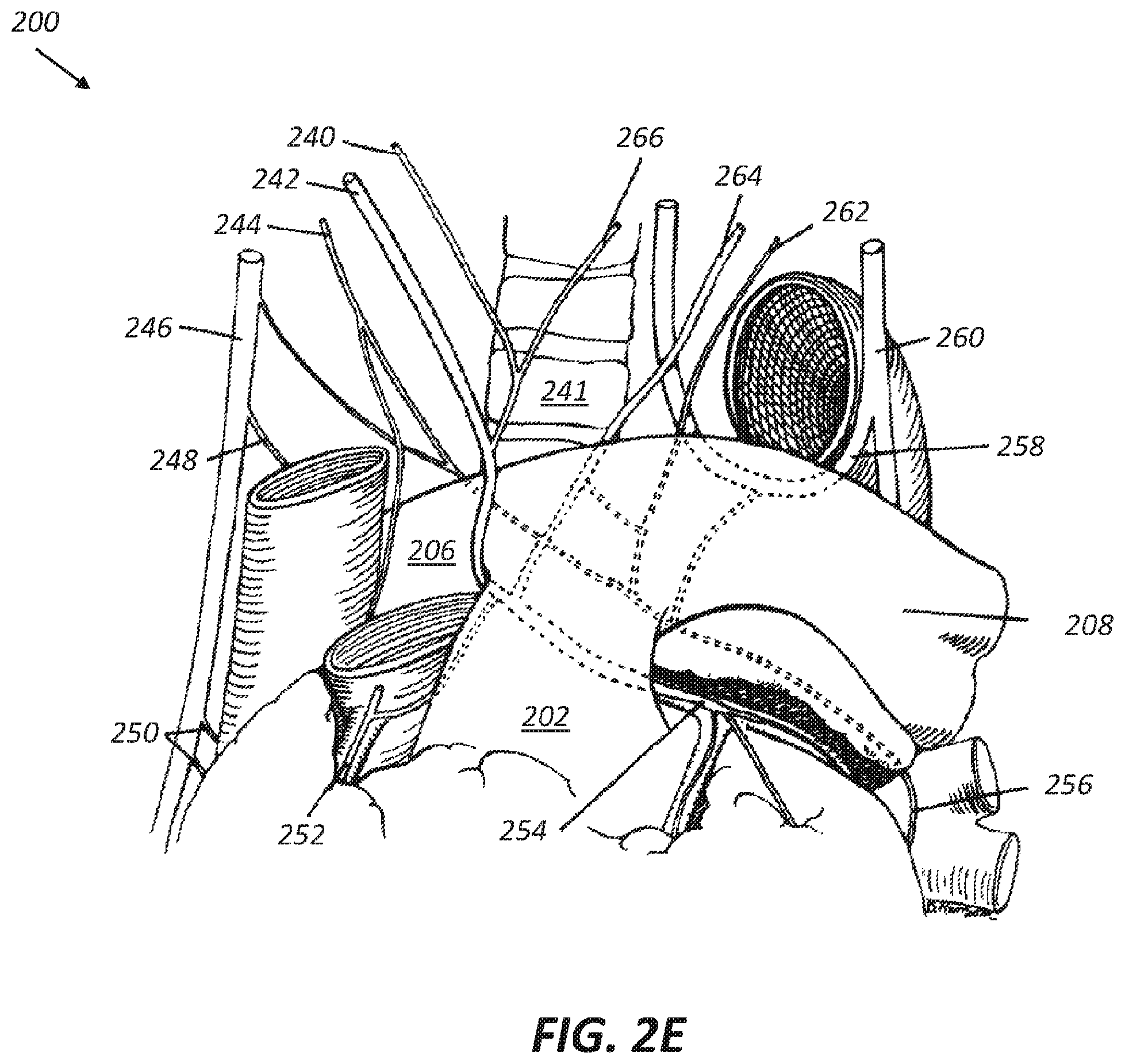 Patent US12569686 Figure 4 – Chronically implantable systems and methods for affecting cardiac contractility and/or relaxation