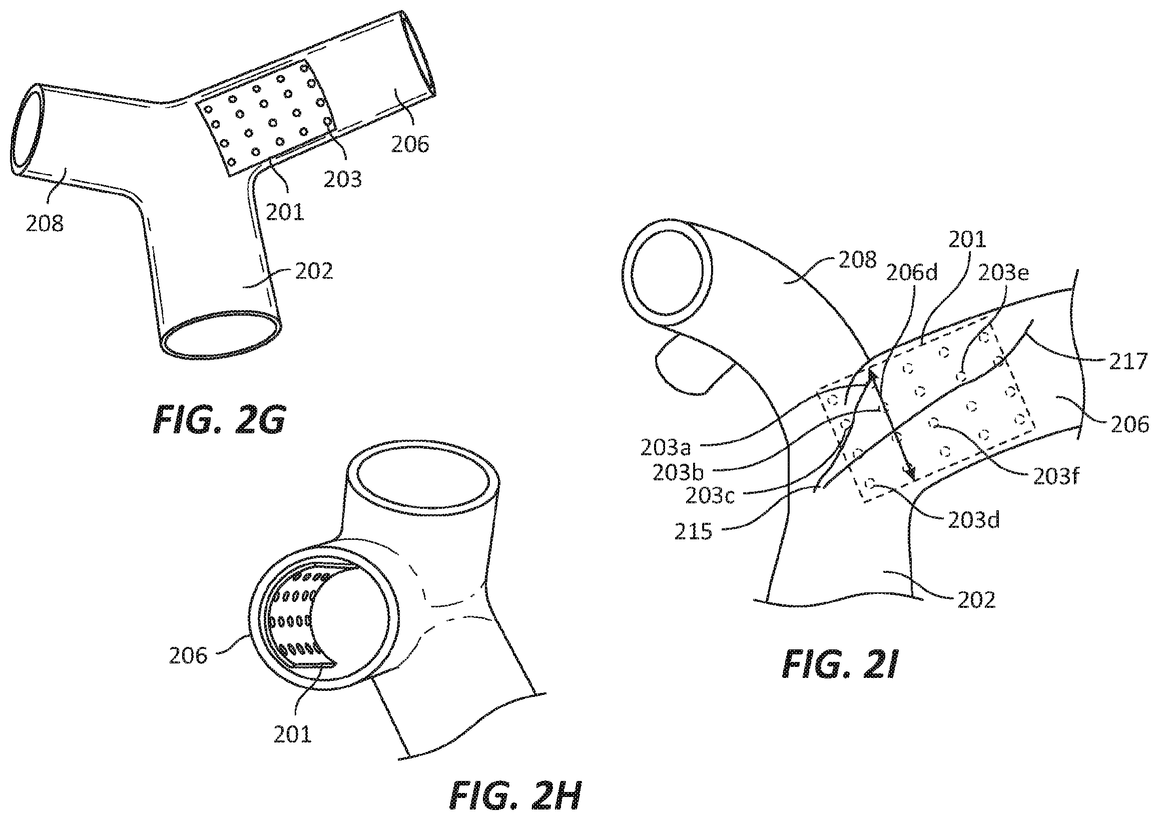 Patent US12569686 Figure 6 – Chronically implantable systems and methods for affecting cardiac contractility and/or relaxation
