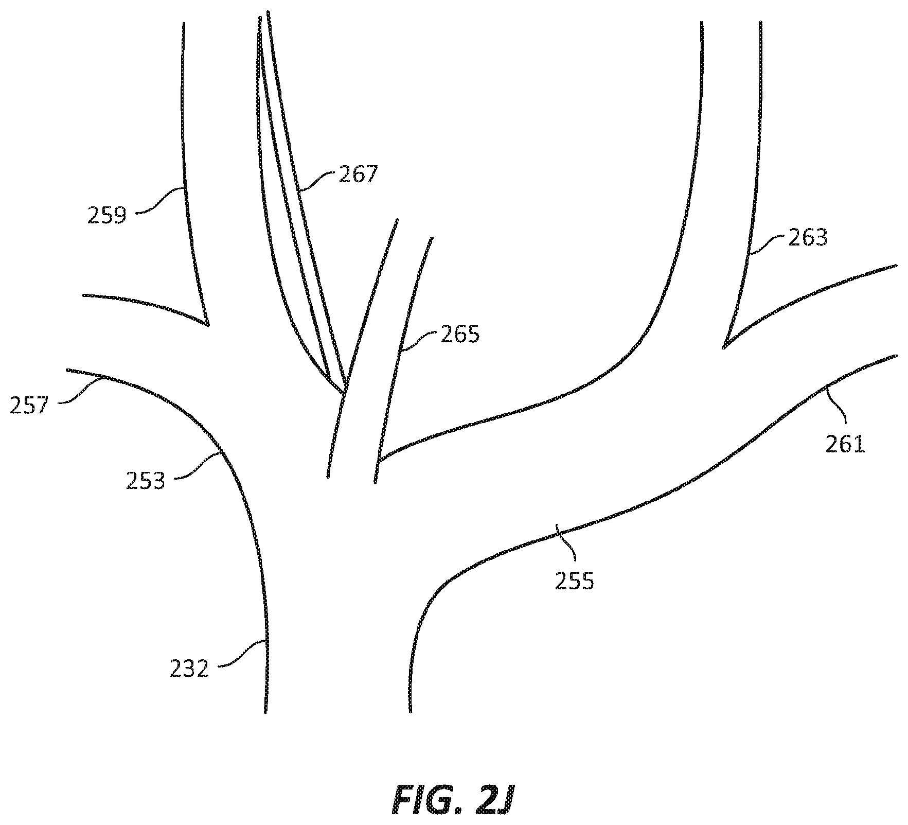 Patent US12569686 Figure 7 – Chronically implantable systems and methods for affecting cardiac contractility and/or relaxation