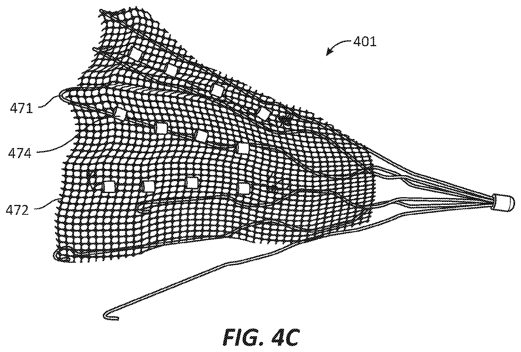 Patent US12569686 Figure 11 – Chronically implantable systems and methods for affecting cardiac contractility and/or relaxation
