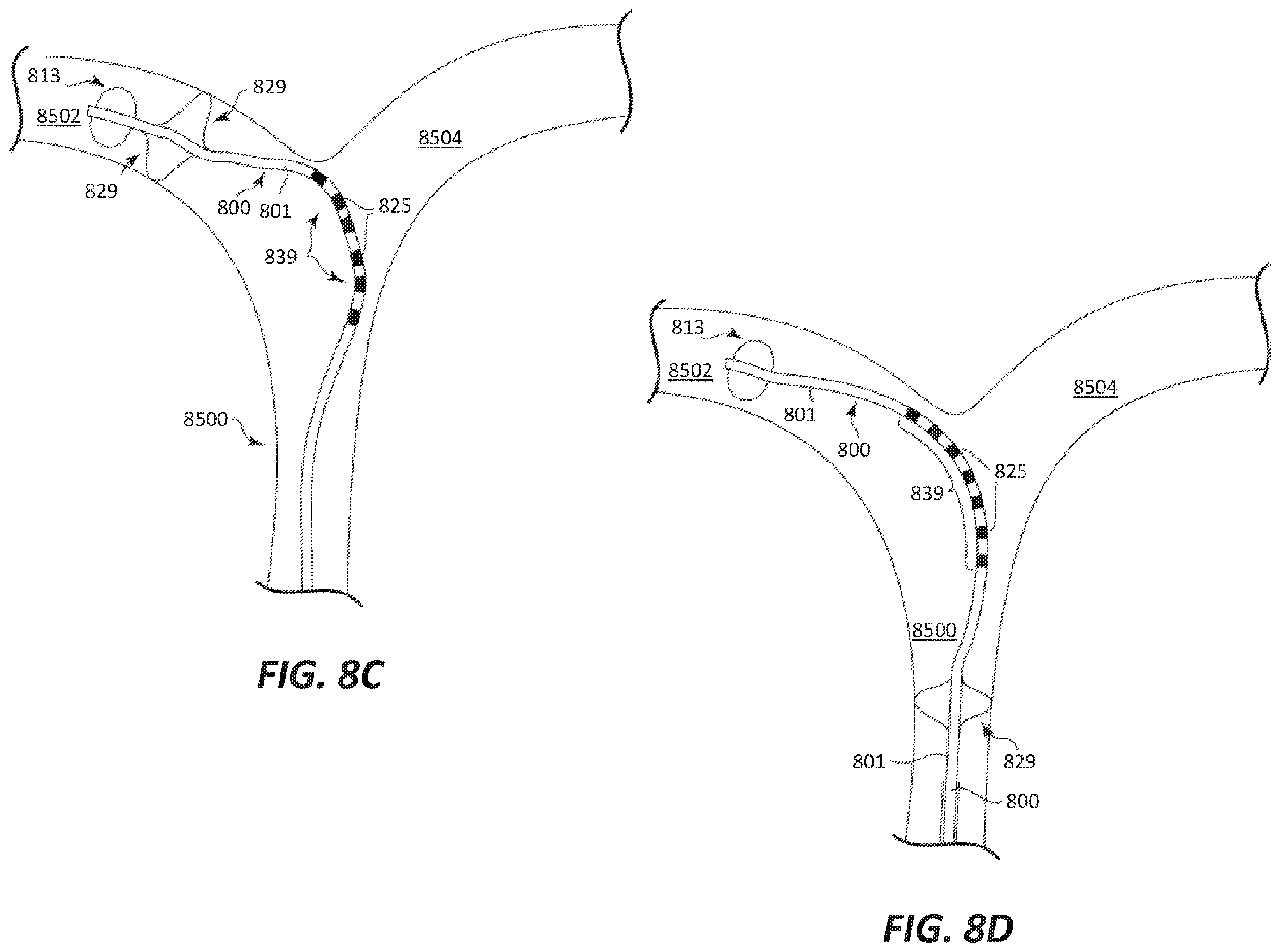 Patent US12569686 Figure 16 – Chronically implantable systems and methods for affecting cardiac contractility and/or relaxation