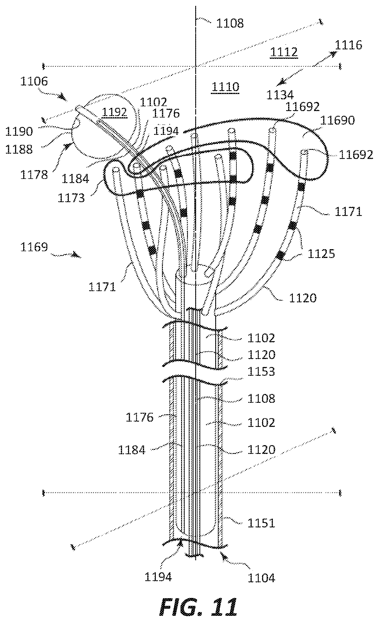 Patent US12569686 Figure 18 – Chronically implantable systems and methods for affecting cardiac contractility and/or relaxation