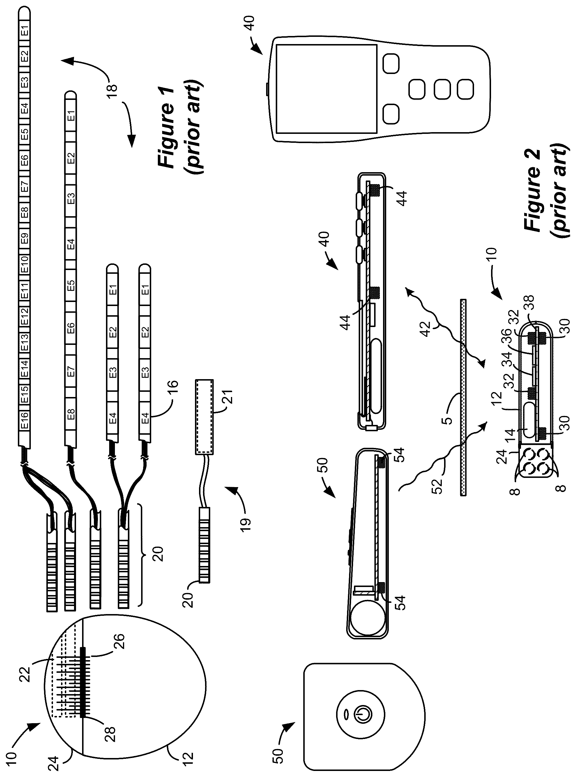 Patent US12569687 Figure 1 – System and method for determination of connected neurostimulation leads