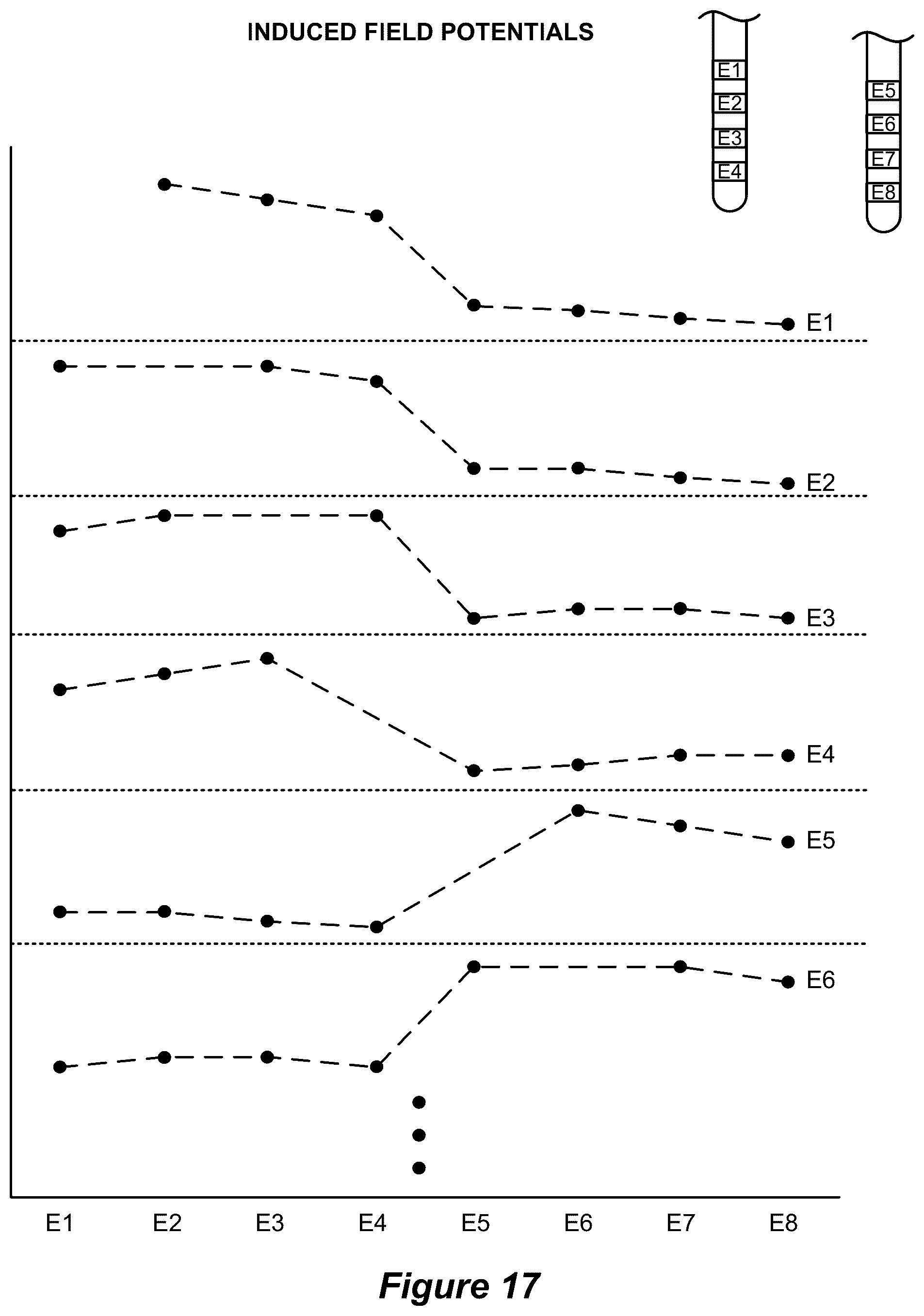 Patent US12569687 Figure 11 – System and method for determination of connected neurostimulation leads