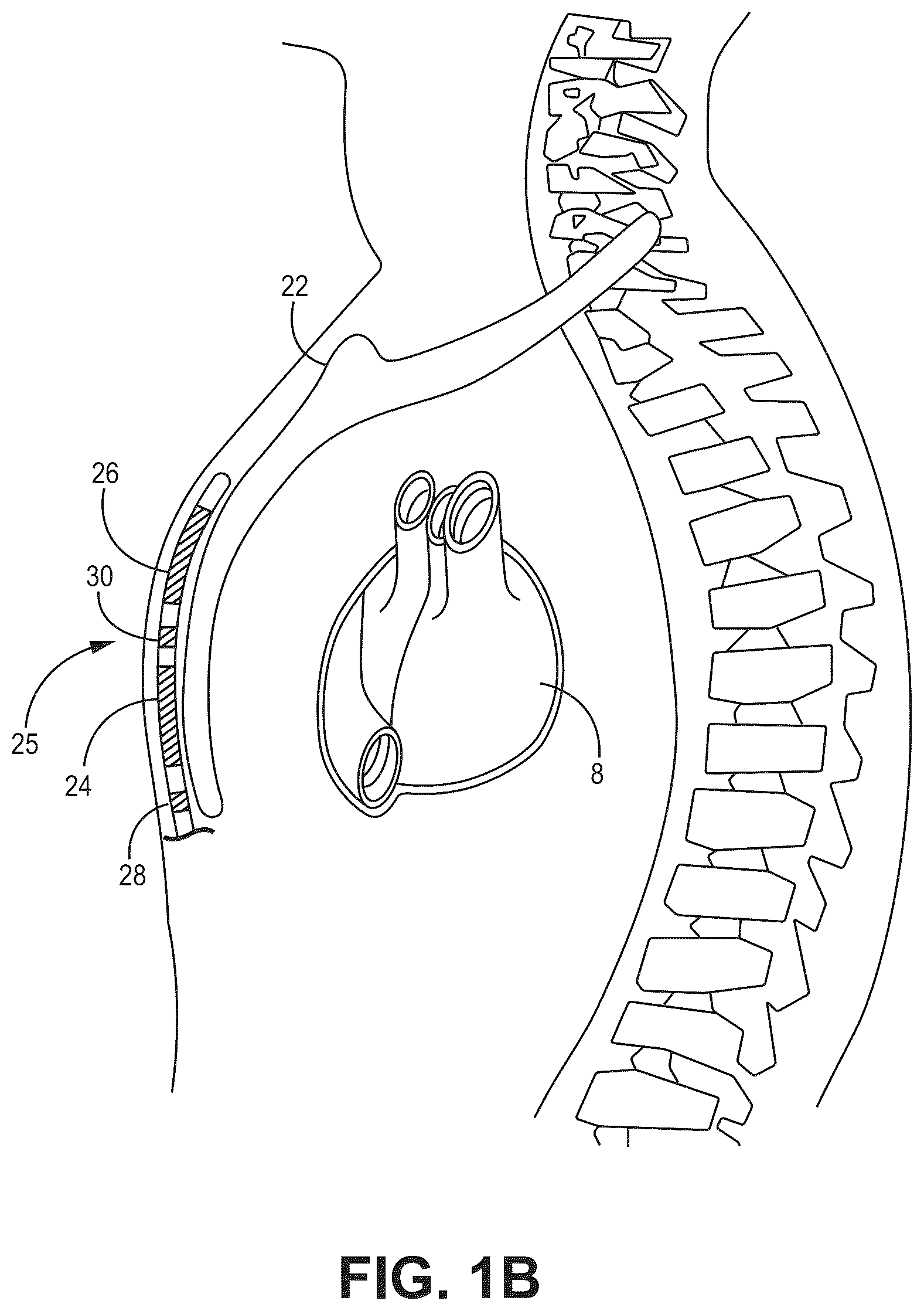 Patent US12569688 Figure 2 – Medical device and method for detecting arrhythmia