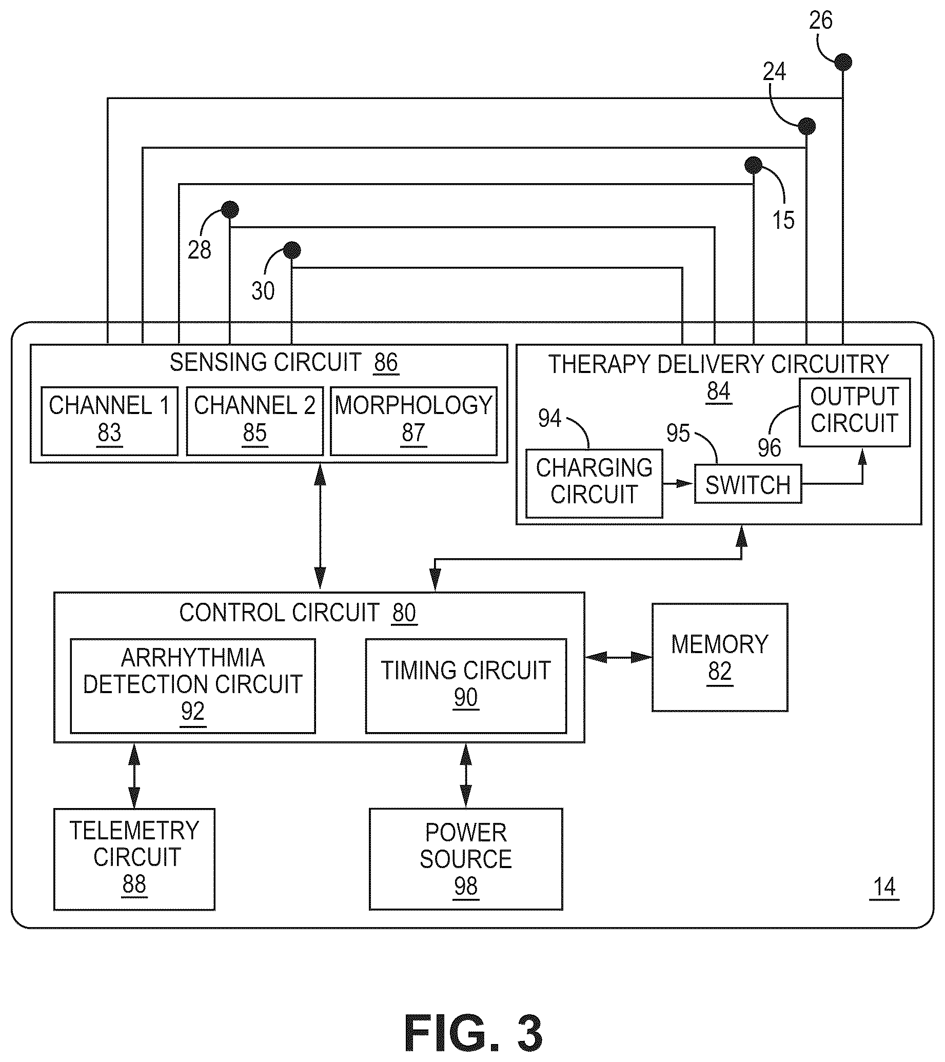 Patent US12569688 Figure 6 – Medical device and method for detecting arrhythmia